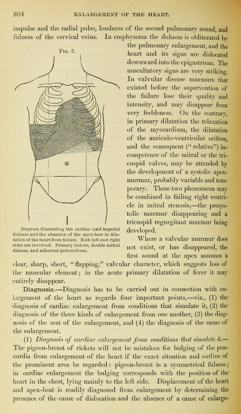 Fig. 3. impulse and the radial pulse, loudness of the second pulmonary sound and fulness of the cervical veins. In emph3'sema the duluess is obliterated by the pulmonary enlargement, and the heart and its signs are dislocated downward into the epigastrium. The auscultatory signs are very striking. In valvular disease murmurs that existed before the supervention of the failure lose their quality and intensity, and may disappear from ' very feebleness. On the contrary, in primary dilatation the relaxation of the myocardium, the dilatation of the auriculo-ventricular orifices, and the consequent ( i-elative) in- competence of the mitral or the tri- cuspid valves, may be attended by the development of a systolic apex- murmur, probably variable and tem- porary. These two phenomena may be combined in failing right ventri- cle in mitral stenosis,—the presys- tolic murmur disappearing and a tricuspid regurgitant murmur being developed. Where a valvular murmur does not exist, or has disappeared, the first sound at the apex assumes a clear, sharp, short,  flapping, valvular character, which suggests loss of the muscular element; in the acute primary dilatation of fever it may entirely disappear. Diagnosis.—Diagnosis has to be carried out in connection with en- largement of the heart as regards four important points,—viz., (1) the diagnosis of cardiac enlargement from conditions that simulate it, (2) the diagnosis of the three kinds of enlargement from one another, (3) the diag- nosis of tlie seat of the enlargement, and (4) the diagnosis of the cause of the enlargement. (1) Diagnosis of cardiac enlargement from conditions that simulate it.— The pigeon-breast of rickets will not be mistaken for bulging of the prse- cordia from enlargement of the heart if the exact situation and outline of the prominent area be regarded: pigeon-breast is a symmetrical fulness; in cardiac enlargement the bulging corresponds with the position of the heart in the chest, lying mainly to the left side. Displacement of the heart and apex-beat is readily diagnosed from enlargement by determining the presence of the cause of dislocation and the absence of a cause of enlarge- Diagram illustrating the cardiac (and hepatic) dulness and the situation of the apex-beat in dila- tation of the heart from failure. Both left and right sides are involved. Primary lesions, double mitral disease, and adherent pericardium.