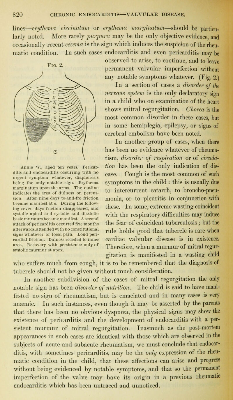 FiQ. 2. lilies—erythema circinatum or erythema marginatum—should be particu- larly noted. More rarely purpura may be the only objective evidence, and occasioDally recent eczema is the sign \\liich induces the suspicion of the rheu- matic condition. In such cases endocarditis and even pericarditis may be observed to arise, to continue, and to leave permanent valvular imperfection without any notable symptoms whatever. (Fig. 2.) In a section of cases a disorder of the nervom system is the only declaratory sign in a child who on examination of the heart shows mitral regui-gitation. Chorea is the most common disorder in these cases, hut in some hemiplegia, epilepsy, or signs of cerebral embolism have been noted. In another group of cases, when there has been no evidence whatever of rheuma- tism, disorder of respiration or of circida- iion has been the only indication of dis- ease. Cough is the most common of such symptoms in the child : this is usually due to intercurrent catarrh, to broncho-pneu- monia, or to pleuritis in conjunction with these. In some, extreme wasting coincident with the respiratory difficulties may induce the fear of coincident tuberculosis; but the Annie W., aged ten years. Pericar- ditis and endocarditis occurring witli no urgent symptom whatever, diaphoresis being the only notable sign. Erythema marginatum upon the arms. The outline indicates the area of dulness on percus- sion. After nine days to-and-fro friction became manifest at a. During the follow- ing seven days friction disappeared, and systolic apical and systolic and diastolic basic murmurs became manifest. A second attacli of pericarditis occurred five months afterwards.attended with no constitutional signs whatever or local pain. Loud peri- cardial friction. Dulness receded to inner area. Recovery with persistence only of systolic murmur at apex. rule holds o-ood that tubercle is rare when cardiac valvular disease is in existence. Therefore, when a murmur of mitral regur- gitation is manifested in a wasting child who suffers much from cough, it is to be remembered that the diagnosis of tubercle should not be given without much consideration. In another subdivision of the cases of mitral regurgitation the only notable sign has been disorder of nutrition. The child is said to have mani- fested no sign of rheumatism, but is emaciated and in many cases is very auEemic. In such instances, even though it may be asserted by the parents that there has been no obvious dyspnoea, the physical signs may show the existence of jjcricarditis and the development of endocarditis with a per- sistent murmur of mitral regurgitation. Inasmuch as the post-mortem appearances in such cases are identical with those which are observed in the subjects of acute and subacute rheumatism, we must conclude that endocar- ditis, with sometimes pericarditis, may be the only expression of the rheu- matic condition in the child, that these affections can arise and progress without being evidenced by notable symptoms, and that so the permanent imperfection of the valve may have its origin in a previous rheumatic endocarditis which has been untraced and unnoticed.