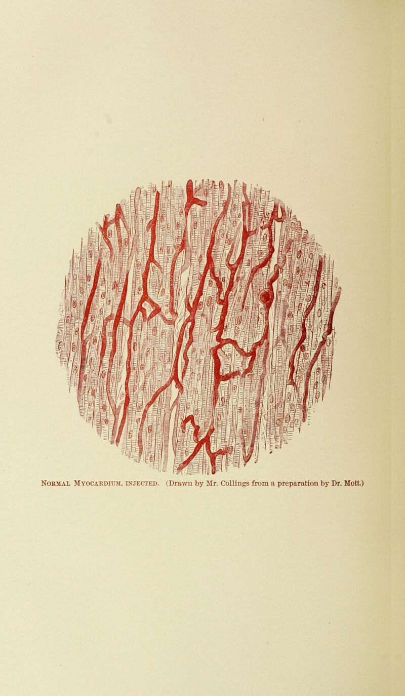 Normal Myocardium, injected. (Drawn by Mr. ColUngs from a preparation by Dr. Mott.)