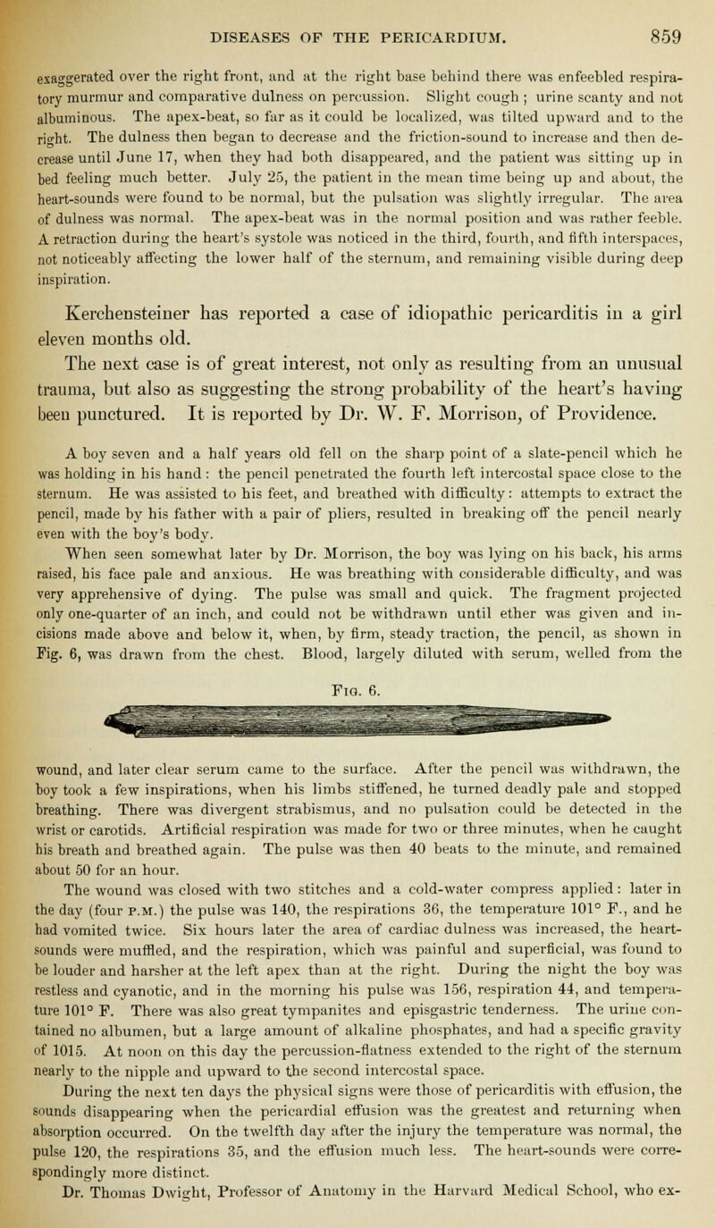 exaggerated over the right front, and at the right base behind there was enfeebled respira- tory murmur and comparative dulness on percussion. Slight cough ; urine scanty and not albuminous. The apex-beat, so far as it could be localized, was tilted upward and to the rio-ht. The dulness then began to decrease and the friction-sound to increase and then de- crease until June 17, when they had both disappeared, and the patient was sitting up in bed feeling much better. July 25, the patient in the mean time being up and about, the heart-sounds were found to be normal, but the pulsation was slightly irregular. The area of dulness was normal. The apex-beat was in the normal position and was rather feeble. A retraction during the heart's systole was noticed in the third, fourth, and tifth interspaces, not noticeably afieeting the lower half of the sternum, and remaining visible during deep inspiration. Kerchensteiner has reported a case of idiopathic pericarditis iu a girl eleven months old. The next case is of great interest, not only as resulting from an uunsual trauma, but also as suggesting the strong probability of the heart's having been punctured. It is reported by Dr. W. F. Morrison, of Providence. A boy seven and a half years old fell on the sharp point of a slate-pencil which ho was holding in his hand : the pencil penetrated the fourth left intercostal space close to the sternum. He was assisted to his feet, and breathed with diflSculty: attempts to extract the pencil, made by his father with a pair of pliers, resulted in breaking off the pencil nearly even with the boy's body. When seen somewhat later by Dr. Morrison, the boy was lying on his back, his arms raised, his face pale and anxious. He was breathing with considerable difficulty, and was very apprehensive of dying. The pulse was small and quick. The fragment projected only one-quarter of an inch, and could not be withdrawn until ether was given and in- cisions made above and below it, when, by firm, steady traction, the pencil, as shown in Pig. 6, was drawn from the chest. Blood, largely diluted with serum, welled from the wound, and later clear serum came to the surface. After the pencil was withdrawn, the boy took a few inspirations, when his limbs stiifened, he turned deadly pale and stopped breathing. There was divergent strabismus, and no pulsation could be detected in the wrist or carotids. Artificial respiration was made for two or three minutes, when he caught his breath and breathed again. The pulse was then 40 beats to the minute, and remained about 50 for an hour. The wound was closed with two stitches and a cold-water compress applied: later in the day (four p.m.) the pulse was 140, the respirations 36, the temperature 101° P., and he had vomited twice. Six hours later the area of cardiac dulness was increased, the heart- sounds were muffled, and the respiration, which was painful and superficial, was found to be louder and harsher at the left apex than at the right. During the night the boy was restless and cyanotic, and in the morning his pulse was 156, respiration 44, and tempera- ture 101° P. There was also great tympanites and episgastric tenderness. The urine con- tained no albumen, but a large amount of alkaline phosphates, and had a specific gravity of 1015. At noon on this day the percussion-flatness extended to the right of the sternum nearly to the nipple and upward to the second intercostal space. During the next ten days the physical signs were those of pericarditis with efi'usion, the sounds disappearing when the pericardial effusion was the greatest and returning when absorption occurred. On the twelfth day after the injury the temperature was normal, the pulse 120, the respirations 35, and the eflTusion much less. The heart-sounds were corre- spondingly more distinct. Dr. Thomas Dwight, Professor of Anatomy in the Harvard Medical School, who ex-