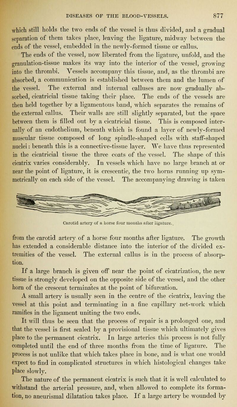 which still holds the two ends of the vessel is thus divided, and a gradual separation of them takes place, leaving the ligature, midway between the ends of the vessel, embedded in the newly-formed tissue or callus. The ends of the vessel, now liberated from the ligature, unfold, and the granulation-tissue makes its way into the interior of the vessel, growing into the thrombi. Vessels accompany this tissue, and, as the thrombi are absorbed, a communication is established between them and the lumen of the vessel. The external and internal calluses are now gradually ab- sorbed, cicatricial tissue taking their place. The ends of the vessels are then held together by a ligamentous band, which separates the remains of the external callus. Their walls are still slightly separated, but the space between them is filled out by a cicatricial tissue. This is composed inter- nally of an endothelium, beneath which is found a layer of newly-formed muscular tissue composed of long spindle-shaped cells with staff-shaped nuclei: beneath this is a connective-tissue layer. We have thus repi'esented in the cicatricial tissue the three coats of the vessel. The shape of this cicatrix varies considerably. In vessels which have no large branch at or near the point of ligature, it is crescentic, the two horns running up sym- metrically on each side of the vessel. The accompanying drawing is taken Carotid artery of a horse four months after ligature.. from the carotid artery of a horse four months after ligature. The growth has extended a considerable distance into the interior of the divided ex- tremities of the vessel. The external callus is in the process of absorp- tion. If a large branch is given off near the point of cicatrization, the new tissue is strongly developed on the opposite side of the vessel, and the other horn of the crescent terminates at the point of bifurcation. A small artery is usually seen in the centre of the cicatrix, leaving the vessel at this point and terminating in a fine capillary net-work which ramifies in the ligament uniting the two ends. It will thus be seen that the process of repair is a prolonged one, and that the vessel is first sealed by a provisional tissue which ultimately gives place to the permanent cicatrix. In large arteries this process is not fully completed until the end of three months from the time of ligature. The process is not unlike that which takes place in bone, and is what one would e.xpect to find in complicated structures in which histological changes take place slowly. The nature of the permanent cicatrix is such that it is well calculated to withstand the arterial pressure, and, Avhen allowed to complete its forma- tion, no aneurismal dilatation takes place. If a large artery be wounded by