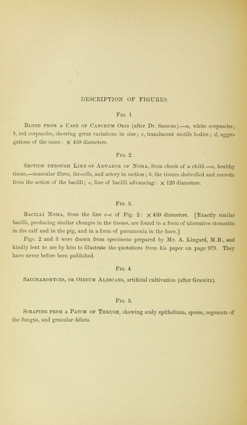 DESCRIPTION OF FIGURES. FlQ. 1, Blood from a Case of Cancrum Oris (after Dr. Sansom).—a, white corpuscles; b, red corpuscles, showing great variations in size; c, translucent motile bodies ; d, aggre- gations of the same : X 450 diameters. Fio. 2. Section through Line of Advance of Noma, from cheek of a child.—a, healthy tissue,—muscular fibres, fat-cells, and artery in section ; b, the tissues shrivelled and necrotic from the action of the bacilli; c, line of bacilli advancing: X 120 diameters. Fig. 3. Bacilli Noma, from the line c-c of Fig. 2: x 450 diameters. [Exactly similar bacilli, producing similar changes in the tissues, are found in a form of ulcerative stomatitis in the calf and in the pig, and in a form of pneumonia in the hare.] Figs. 2 and 3 were drawn from specimens prepared by Mr. A. Lingard, M.B., and kindly lent to me by him to illustrate the quotations from bis paper on page 979. They have never before been published. Fig. 4. Saccharomyces, or Oidium Albicans, artificial cultivation (after Grawitz). Fig. 5. Scraping from a Patch of Thrush, showing scaly epithelium, spores, segments of the fungus, and granular debris.