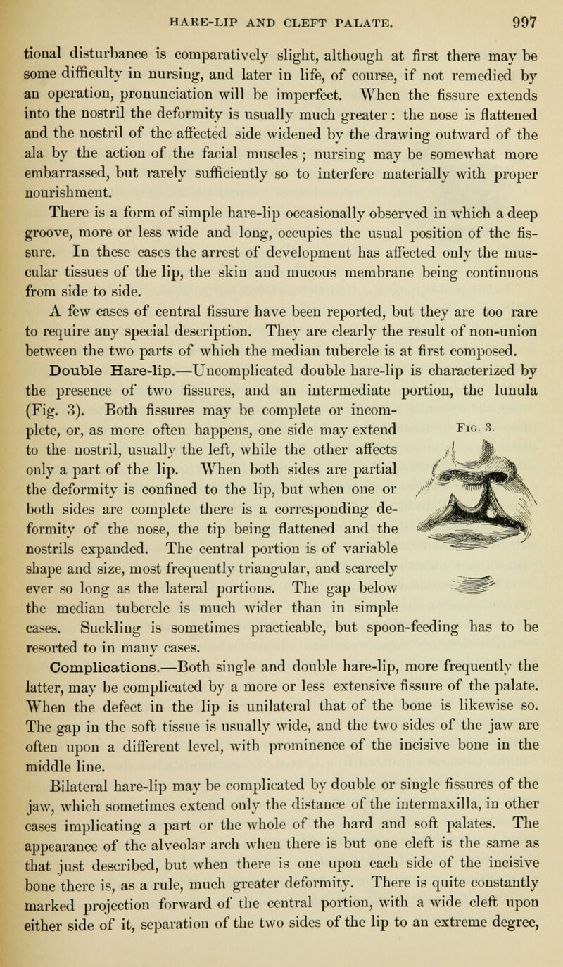 tioaal disturbance is comparatively slight, although at first there may be some difficulty in nursing, and later in life, of course, if not remedied by an operation, pronunciation will be imperfect. When the fissure extends into the nostril the deformity is usually much greater : the nose is flattened and the nostril of the aifected side widened by the drawiug outward of the ala by the action of the facial muscles; nursing may be somewhat more embarrassed, but mrely sufficiently so to interfere materially with proper nourishment. There is a form of simple hare-lip occasionally observed in which a deep groove, more or less wide and long, occupies the usual position of the fis- sure. In these cases the arrest of development has affected only the mus- cular tissues of the lip, the skin and mucous membrane being continuous from side to side. A few cases of central fissure have been reported, but they are too rare to require any special description. They are clearly the result of non-union between the two parts of which the median tubercle is at first composed. Double Hare-lip.—Uncomplicated double hare-lip is characterized by the presence of two fissures, and an intermediate portion, the lunula (Fig. 3). Both fissures may be comj^lete or incom- plete, or, as more often happens, one side may extend to the nostril, usually the left, while the other affects only a part of the lip. When both sides are partial the deformity is confined to the lip, but when one or both sides are complete there is a corresponding de- formity of the nose, the tip being flattened and the nostrils expanded. The central portion is of variable shape and size, most frequently triangular, and scarcely ever so long as the lateral portions. The gap below ^^^0 the median tubercle is much wider than in simple cases. Suckling is sometimes practicable, but spoon-feeding has to be resorted to in many cases. Complications.—Both single and double hare-lip, more frequently the latter, may be complicated by a more or less extensive fissure of the palate. When the defect in the lip is unilateral that of the bone is likewise so. The gap in the soft tissue is usually wide, and the two sides of the jaw are often upon a different level, with prominence of the incisive bone in the middle line. Bilateral hare-lip may be complicated by double or single fissures of the jaw, which sometimes extend only the distance of the intermaxilla, in other cases implicating a part or the whole of the hard and soft palates. The appearance of the alveolar arch when there is but one cleft is the same as that just described, but when there is one upon each side of the incisive bone there is, as a rule, much greater deformity. There is quite constantly marked projection forward of the central portion, with a wide cleft upon either side of it, separation of the two sides of the lip to an extreme degree,