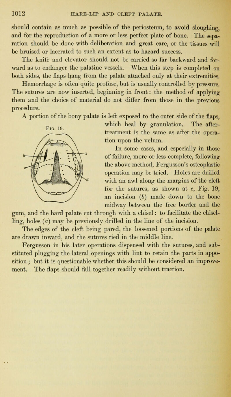 should contain as much as possible of the periosteum, to avoid sloughing, and for the reproduction of a more or less perfect plate of bone. The sepa- ration should be done with deliberation and great care, or the tissues will be bruised or lacerated to such an extent as to hazard success. The knife and elevator should not be carried so far backward and for- ward as to endanger the palatine vessels. When this step is completed on both sides, the flaps hang from the palate attached only at their extremities. Hemorrhage is often quite profuse, but is usually controlled by pressure. The sutures are now inserted, beginning in front: the method of applying them and the choice of material do not differ from those in the previous procedure. A portion of the bony palate is left exposed to the outer side of the flaps, which heal by granulation. The after- treatment is the same as after the opera- tion upon the velum. In some cases, and especially in those of failure, more or less complete, following the above method, Fergusson's osteoplastic operation may be tried. Holes are drilled with an awl along the margins of the cleft for the sutures, as shown at c. Fig. 19, an incision (6) made down to the bone midway between the free border and the gum, and the hard palate cut through with a chisel: to facilitate the chisel- ling, holes (ct) may be previously drilled in the line of the incision. The edges of the cleft being pared, the loosened portions of the palate are drawn inward, and the sutures tied in the middle line. Fergusson in his later operations dispensed with the sutures, and sub- stituted plugging the lateral openings with lint to retain the parts in appo- sition ; but it is questionable whether this should be considered an improve- ment. The flaps should fall together readily without traction.