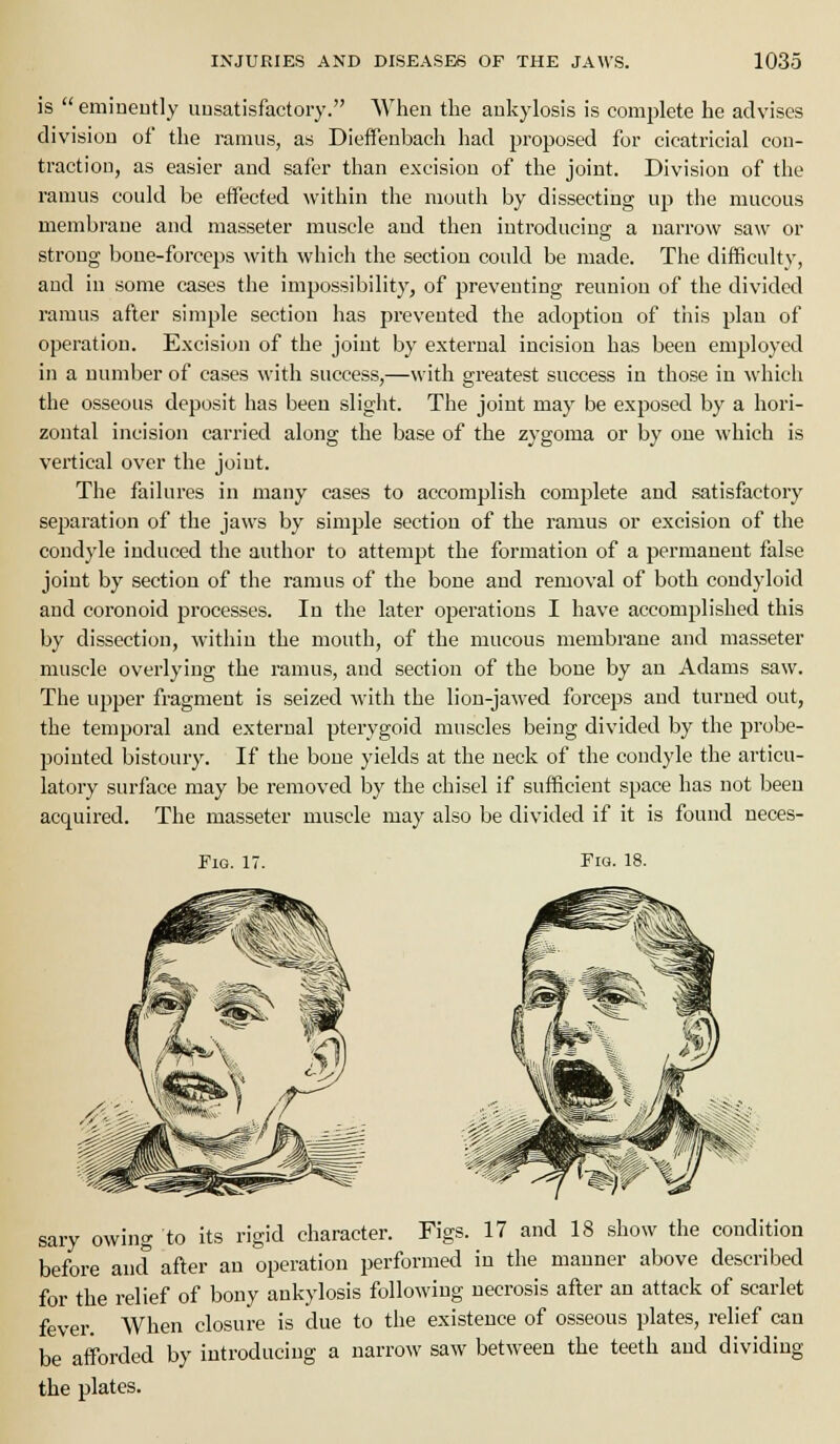 is  eminently unsatisfactory. When the ankylosis is complete he advises division of the ramus, as Dieffenbach had proposed for cicatricial con- traction, as easier and safer than excision of the joint. Division of the ramus could be effected within the mouth by dissecting up the mucous membrane and masseter muscle and then introducing a narrow saw or strong bone-forceps with which the section could be made. The difficulty, and in some cases the imjjossibility, of preventing reunion of the divided ramus after simple section has prevented the adoption of tiiis plan of operation. Excision of the joint by external incision has been employed in a number of cases with success,—with greatest success in those in which the osseous deposit has been slight. The joint may be exposed by a hori- zontal incision carried along the base of the zygoma or by one which is vertical over the joint. The failures in many cases to accomplish complete and satisfactory sejjaration of the jaws by simple section of the ramus or excision of the condyle induced the author to attemj)t the formation of a permanent false joint by section of the ramus of the bone and removal of both condyloid and coronoid processes. In the later operations I have accomplished this by dissection, within the mouth, of the mucous membrane and masseter muscle overlying the I'amus, and section of the bone by an Adams saw. The upper fragment is seized with the lion-jawed forceps and turned out, the temporal and external pterygoid muscles being divided by the probe- pointed bistoury. If the bone yields at the neck of the condyle the articu- latory surface may be removed by the chisel if sufficient space has not been acquired. The masseter muscle may also be divided if it is found neces- FiG. 17. Fro. 18. sary owing to its rigid character. Figs. 17 and 18 show the condition before ancl after an operation performed in the manner above described for the relief of bony ankylosis following necrosis after an attack of scarlet fever. When closure is due to the existence of osseous plates, relief can be afforded by introducing a narrow saw between the teeth and dividing the plates.