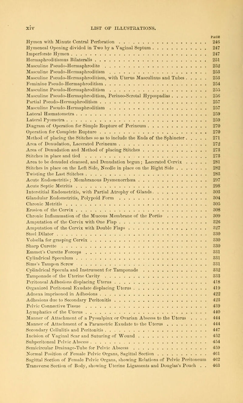 PAGE Hymen with Minute Central Perforation 246 Hymeneal Opening divided in Two by a Vaginal Septum 247 Imperforate Hymen 247 Hermaphroditismus Bilateralis 251 Masculine Pseudo-Hermaphrodite 252 Masculine Pseudo-Hermaphroditism 253 Masculine Pseudo-Hermaphroditism, with Uterus Masculinus and Tubes 253 Feminine Pseudo-Hermaphroditism 254 Masculine Pseudo-Hermaphroditism 255 Masculine Pseudo-Hermaphroditism, Perineo-Scrotal Hypospadias 256 Partial Pseudo-IIermaphroditism 257 Masculine Pseudo-Hermaphroditism 257 Lateral H;ematometra 259 Lateral Pyometra 259 Diagram of Operation for Simple Rupture of Perineum 270 Operation for Complete Kupture 270 Method of placing the Stitches so as to include the Ends of the Sphincter 271 Area of Denudation, Lacerated Perineum 272 Area of Denudation and Method of placing Stitches 273 Stitches in place and tied 273 Area to be denuded cleansed, and Denudation begun ; Lacerated Cervix 281 Stitches in place on the Left Side, Needle in place on the Right Side 282 Twisting the Last Stitches 283 Acute Endometritis ; Membranous Dysmenorrhoea 297 Acute Septic Metritis 298 Interstitial Endometritis, with Partial Atrophy of Glands 303 Glandular Endometritis, Polypoid Form 304 Chronic Metritis 305 Erosion of the Cervix 308 Chronic Inflammation of the Mucous Membrane of the Portio 309 Amputation of the Cervix with One Flap 326 Amputation of the Cervix with Double Flaps 327 Steel Dilator 330 Volsella for grasping Cervix 330 Sharp Curette 330 Emmet's Curette Forceps 331 Cylindrical Speculum 331 Sims's Tampon Screw 331 Cylindrical Specula and Instrument for Tamponade 332 Tamponade of the Uterine Cavity 333 Peritoneal Adhesions displacing Uterus 418 Organized Peritoneal Exudate displacing Uterus 419 Adnexa imprisoned in Adhesions 422 Adhesions due to Secondary Peritonitis 423 Pelvic Connective Tissue 439 Lymphatics of the Uterus 440 Manner of Attachment of a Pyosalpinx or Ovarian Abscess to the Uterus .... 444 Manner of Attachment of a Parametric Exudate to the Uterus 444 Secondary Cellulitis and Peritonitis 447 Incision of Vaginal Scar and Suturing of Wound 452 Subperitoneal Pelvic Abscess 454 Semicircular Drainage-Tube for Pelvic Abscess 459 Normal Position of Female Pelvic Organs, Sagittal Section 461 Sagittal Section of Female Pelvic Organs, showing Relations of Pelvic Peritoneum 462 Transverse Section of Body, showing Uterine Ligaments and Douglas's Pouch . . 463