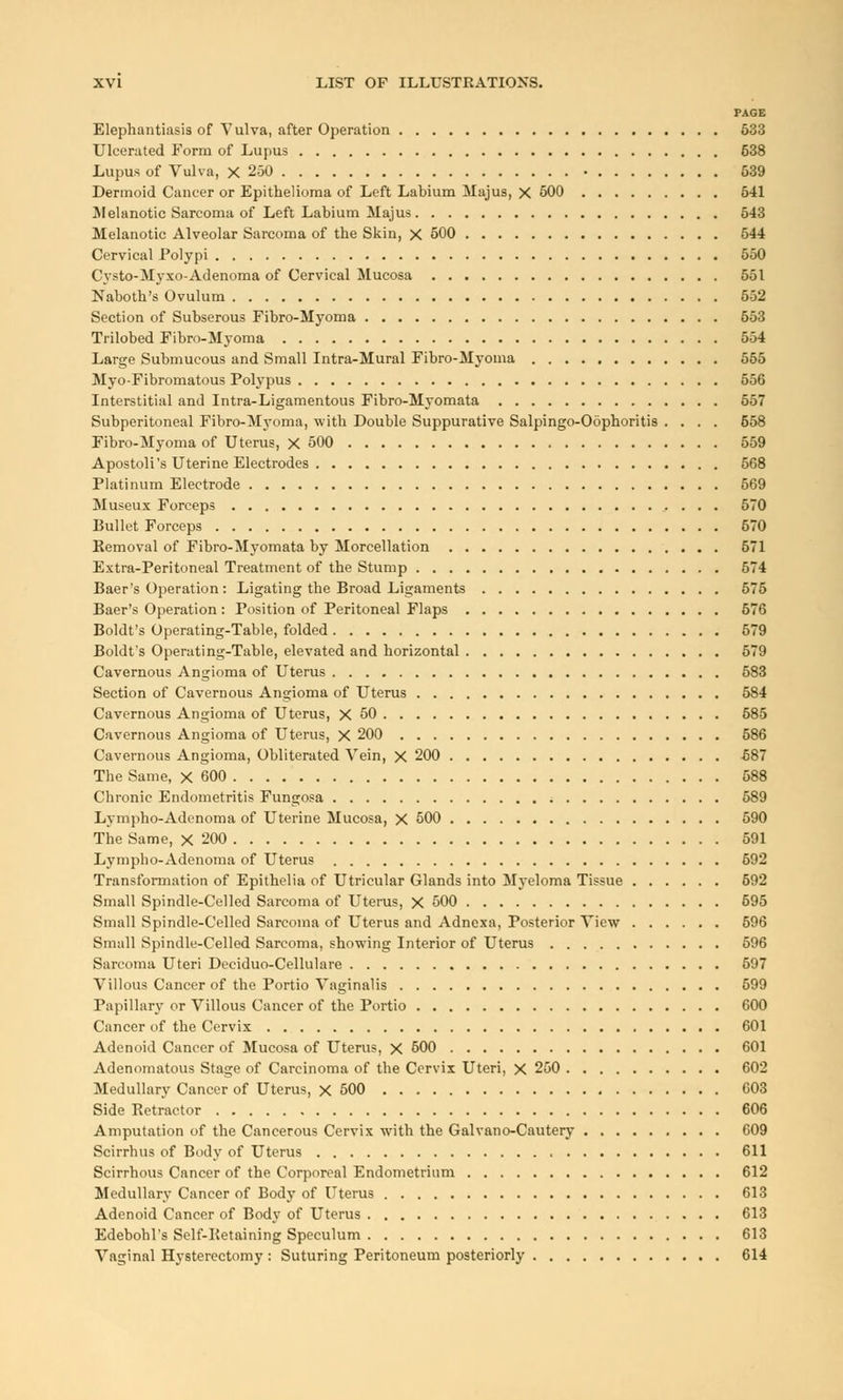 PAGE Elephantiasis of Vulva, after Operation 633 Ulcerated Form of Lupus 638 Lupus of Vulva, X 250 • 639 Dermoid Cancer or Epithelioma of Left Labium Majus, X 500 541 Melanotic Sarcoma of Left Labium Majus 543 Melanotic Alveolar Sarcoma of the Skin, X 500 544 Cervical Polypi 550 Cysto-Myxo-Adenoma of Cervical Mucosa 551 Naboth's Ovulum 552 Section of Subserous Fibro-Myoma 653 Trilobed Fibro-Myoma 554 Large Submucous and Small Intra-Mural Fibro-Myoma 555 Myo-Fibromatous Polypus 556 Interstitial and Intra-Ligamentous Fibro-Myomata 557 Subperitoneal Fibro-Myoma, with Double Suppurative Salpingo-Oophoritis .... 658 Fibro-Myoma of Uterus, X 500 559 Apostoli's Uterine Electrodes 568 Platinum Electrode 569 Museux Forceps 570 Bullet Forceps 670 Removal of Fibro-Myomata by Morcellation 571 Extra-Peritoneal Treatment of the Stump 574 Baer's Operation : Ligating the Broad Ligaments 575 Baer's Operation : Position of Peritoneal Flaps 576 Boldt's Operating-Table, folded 579 Boldt's Operating-Table, elevated and horizontal 579 Cavernous Angioma of Uterus 583 Section of Cavernous Angioma of Uterus 584 Cavernous Angioma of Uterus, X 50 685 Cavernous Angioma of Uterus, X 200 586 Cavernous Angioma, Obliterated Vein, X 200 -587 The Same, X 600 588 Chronic Endometritis Fungosa 589 Lympho-Adenoma of Uterine Mucosa, X 500 590 The Same, X 200 591 Lympho-Adenoma of Uterus 592 Transformation of Epithelia of Utricular Glands into Myeloma Tissue 692 Small Spindle-Celled Sarcoma of Uterus, X 500 595 Small Spindle-Celled Sarcoma of Uterus and Adncxa, Posterior View 596 Small Spindle-Celled Sarcoma, showing Interior of Uterus 596 Sarcoma Uteri Deciduo-Cellulare 597 Villous Cancer of the Portio Vaginalis 599 Papillary or Villous Cancer of the Portio 600 Cancer of the Cervix 601 Adenoid Cancer of Mucosa of Uterus, X 500 601 Adenomatous Stage of Carcinoma of the Cervix Uteri, X 250 602 Medullary Cancer of Uterus, X 500 603 Side Retractor 606 Amputation of the Cancerous Cervix with the Galvano-Cautery 609 Scirrhus of Body of Uterus 611 Scirrhous Cancer of the Corporeal Endometrium 612 Medullary Cancer of Body of Uterus 613 Adenoid Cancer of Body of Uterus 613 Edebohl's Self-Retaining Speculum 613 Vaginal Hysterectomy : Suturing Peritoneum posteriorly 614