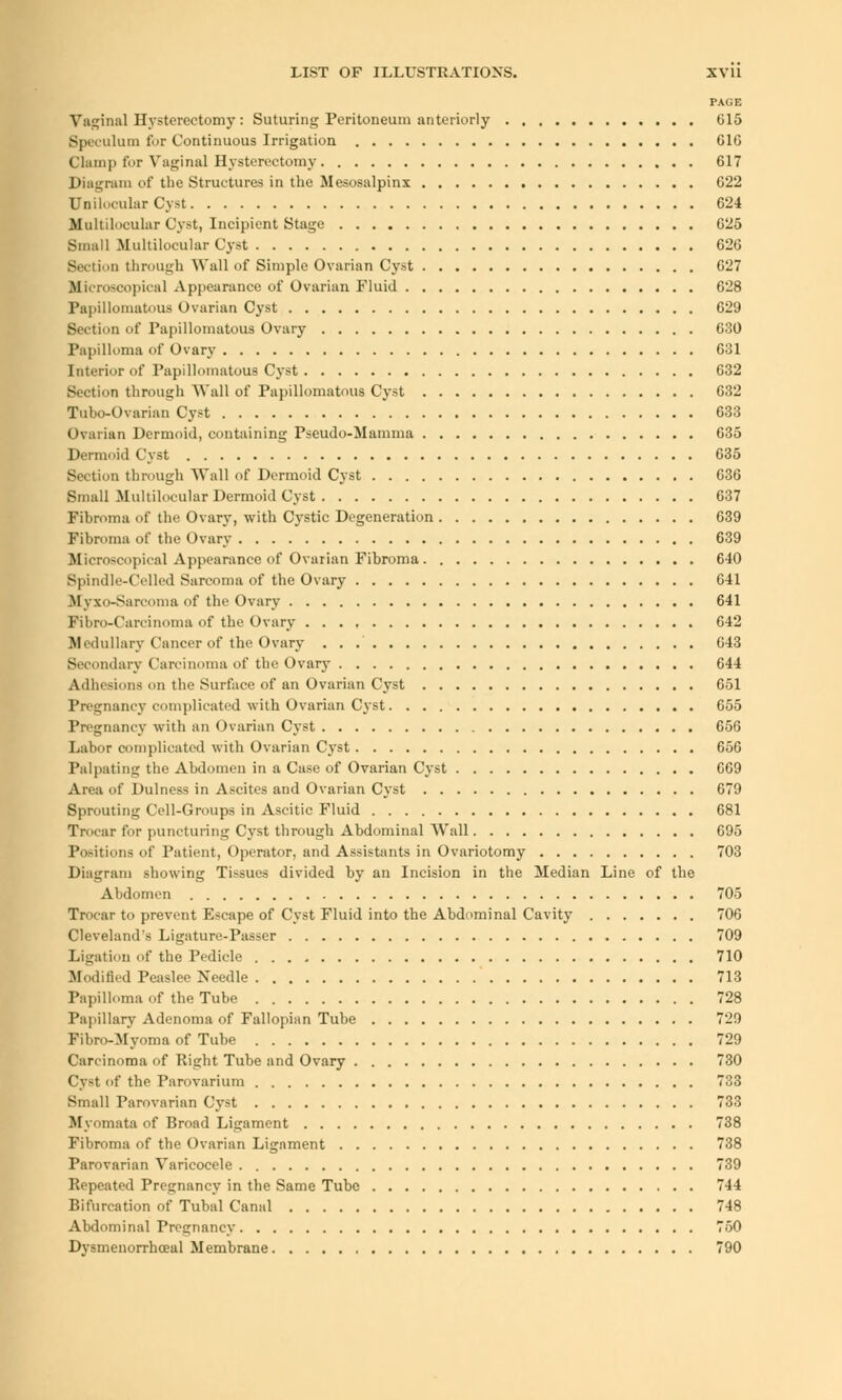 PAGE Vaginal Hysterectomy : Suturing Peritoneum anteriorly 615 Speculum for Continuous Irrigation 610 Chimp for Vaginal Hysterectomy 617 Diagram of the Structures in the Mesosalpinx 622 Unilocular Cyst 624 Multilocular Cyst, Incipient Stage 625 Small Multilocular Cyst 626 Section through Wall of Simple Ovarian Cyst 627 Microscopical Appearance of Ovarian Fluid 628 Papillomatous Ovarian Cyst 629 Section of Papillomatous Ovary 630 Papilloma of Ovary 631 Interior of Papillomatous Cyst 632 Section through Wall of Papillomatous Cyst 632 Tubo-Ovarian Cyst 633 Ovarian Dermoid, containing Pseudo-Mamma 635 Dermoid Cyst 635 Section through Wall of Dermoid Cyst 636 Small Multilocular Dermoid Cyst 637 Fibroma <>f the Ovary, with Cystic Degeneration 639 Fibroma of the Ovary 639 Microscopical Appearance of Ovarian Fibroma 640 Spindle-Celled Sarcoma of the Ovary 641 Myxo-Sarcoma of the Ovary 641 Fibro-Carcinoma of the Ovary 642 Medullary Cancer of the Ovary 643 Secondary Carcinoma of the Ovary 644 Adhesions on the Surface of an Ovarian Cyst 651 Pregnancy complicated with Ovarian Cyst 655 Pregnancy with an Ovarian Cyst 656 Labor complicated with Ovarian Cyst 656 Palpating the Abdomen in a Case of Ovarian Cyst 669 Area of Dulness in Ascites and Ovarian Cyst 679 Sprouting Cell-Groups in Ascitic Fluid 681 Trocar for puncturing Cyst through Abdominal Wall 095 Positions of Patient, Operator, and Assistants in Ovariotomy 703 Diagram showing Tissues divided by an Incision in the Median Line of the Abdomen 705 Trocar to prevent Escape of Cyst Fluid into the Abdominal Cavity 706 Cleveland's Ligature-Passer 709 Ligation of the Pedicle 710 Modified Peaslee Needle 713 Papilloma of the Tube 728 Papillary Adenoma of Fallopian Tube 729 Pibro-Myoma of Tube 729 Carcinoma of Right Tube and Ovary 730 Cyst <>f the Parovarium 733 Small Parovarian Cyst 733 Myomata of Broad Ligament 738 Fibroma of the Ovarian Ligament 738 Parovarian Varicocele 739 Repeated Pregnancy in the Same Tube 744 Bifurcation of Tubal Canal 748 Abdominal Pregnancy 750 Dysmenorrhceal Membrane 790