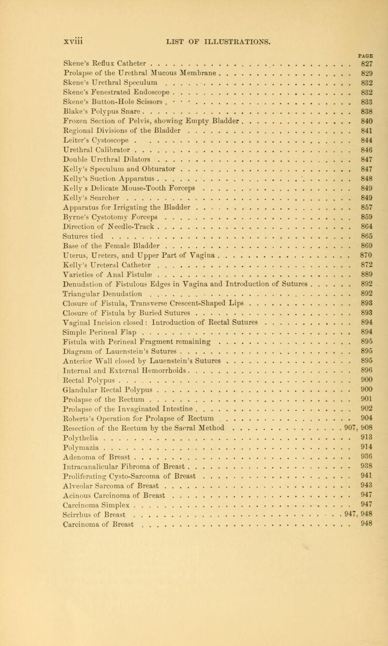 PAGE Skene's Reflux Catheter 827 Prolapse of the Urethral Mucous Membrane 829 Skene's Urethral Speculum 832 Skene's Fenestrated Endoscope 832 Skene's Button-Hole Scissors . • • • 833 Blake's Polypus Snare 838 Frozen Section of Pelvis, showing Empty Bladder 840 Regional Divisions of the Bladder 841 Leiter's Cystoscope 844 Urethral Calibrator 846 Double Urethral Dilators 847 Kelly's Speculum and Obturator 847 Kelly's Suction Apparatus ' 848 Kelly s Delicate Mouse-Tooth Forceps 849 Kelly's Searcher 849 Apparatus for Irrigating the Bladder 857 Byrne's Cystotomy Forceps 859 Direction of Needle-Track 8G4 Sutures tied 865 Base of the Female Bladder 869 Uterus, Ureters, and Upper Part of Vagina 870 Kelly's Ureteral Catheter 872 Varieties of Anal Fistula? 889 Denudation of Fistulous Edges in Vagina and Introduction of Sutures 892 Triangular Denudation 892 Closure of Fistula, Transverse Crescent-Shaped Lips 893 Closure of Fistula by Buried Sutures 893 Vaginal Incision closed : Introduction of Rectal Sutures 894 Simple Perineal Flap 894 Fistula with Perineal Fragment remaining 895 Diagram of Laucnstein's Sutures 895 Anterior Wall closed by Lauenstein's Sutures 895 Internal and External Hemorrhoids 896 Rectal Polypus 900 Glandular Rectal Polypus 900 Prolapse of the Rectum 901 Prolapse of the Invaginated Intestine 902 Roberts's Operation for Prolapse of Rectum 904 Resection of the Rectum by the Sacral Method 907, 908 Polythelia 913 Polymazia 914 Adenoma of Breast 936 Intracanalicular Fibroma of Breast 938 Proliferating Cysto-Sarcoma of Breast 941 Alveolar Sarcoma of Breast 943 Acinous Carcinoma of Breast 947 Carcinoma Simplex 947 Scirrhus of Breast 947, 948 Carcinoma of Breast 948