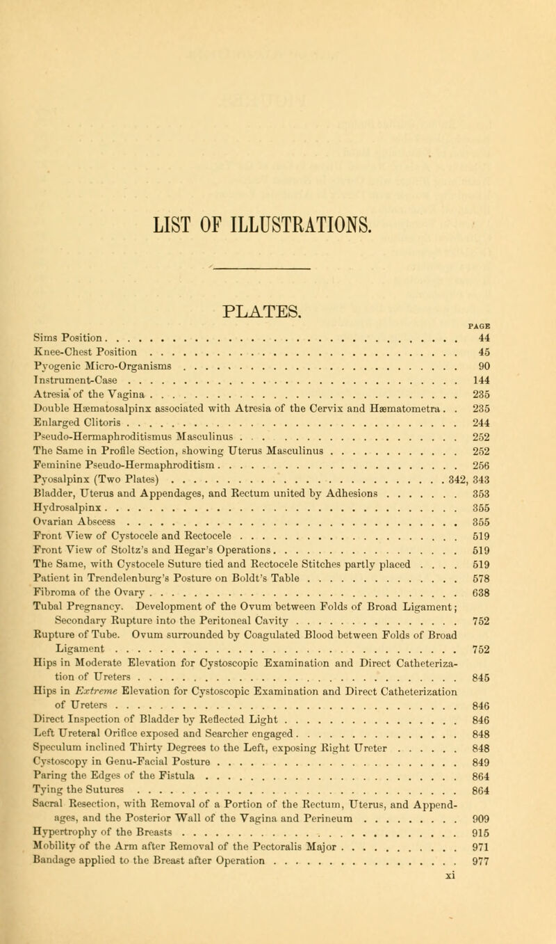 LIST OF ILLUSTRATIONS. PLATES. PAGE Sims Position 44 Knee-Chest Position 45 Pyogenic Micro-Organisms 90 Instrument-Case 144 Atresia'of the Vagina 235 Double Hematosalpinx associated with Atresia of the Cervix and Haematometra . . 235 Enlarged Clitoris 244 Pseudo-Hermaphroditismus Masculinus ... 252 The Same in Profile Section, showing Uterus Masculinus 252 Feminine Pseudo-Hermaphroditism 256 Pyosalpinx (Two Plates) 342, 343 Bladder, Uterus and Appendages, and Kectum united by Adhesions 353 Hydrosalpinx 355 Ovarian Abscess 355 Front View of Cystocele and Kectocele 519 Front View of Stoltz's and Hegar's Operations 519 The Same, with Cystocele Suture tied and Kectocele Stitches partly placed .... 519 Patient in Trendelenburg's Posture on Boldt's Table 578 Fibroma of the Ovary 638 Tubal Pregnancy. Development of the Ovum between Folds of Broad Ligament; Secondary Eupture into the Peritoneal Cavity 752 Rupture of Tube. Ovum surrounded by Coagulated Blood between Folds of Broad Ligament 752 Hips in Moderate Elevation for Cystoscopic Examination and Direct Catheteriza- tion of Ureters 845 Hips in Extreme Elevation for Cystoscopic Examination and Direct Catheterization of Ureters 846 Direct Inspection of Bladder by Reflected Light 846 Left Ureteral Orifice exposed and Searcher engaged 848 Speculum inclined Thirty Degrees to the Left, exposing Right Ureter 848 Cystoscopy in Genu-Facial Posture 849 Paring the Edges of the Fistula 864 Tying the Sutures 864 Sacral Resection, with Removal of a Portion of the Rectum, Uterus, and Append- age*, and the Posterior Wall of the Vagina and Perineum 909 Hypertrophy of the Breasts 915 Mobility of the Arm after Removal of the Pectoralis Major 971 Bandage applied to the Breast after Operation 977