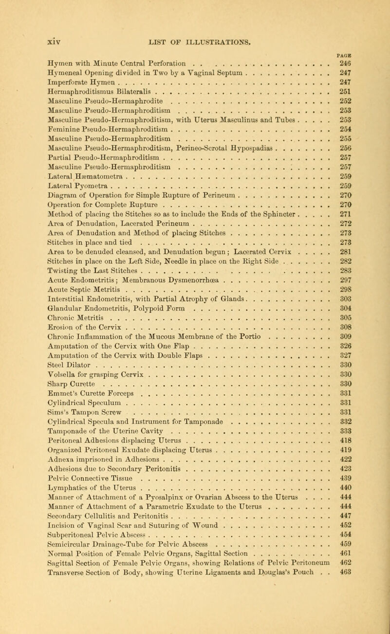 PAGE Hymen with Minute Central Perforation 246 Hymeneal Opening divided in Two by a Vaginal Septum 247 Imperforate Hymen 247 Hermaphroditism^ Bilateralis 251 Masculine Pseudo-Hermaphrodite 252 Masculine Pseudo-Hermaphroditism 253 Masculine Pseudo-Hermaphroditism, with Uterus Masculinus and Tubes 253 Feminine Pseudo-Hermaphroditism 254 Masculine Pseudo-Hermaphroditism 255 Masculine Pseudo-Hermaphroditism, Perineo-Scrotal Hypospadias 256 Partial Pseudo-Hermaphroditism 257 Masculine Pseudo-Hermaphroditism \ 257 Lateral Haematometra 259 Lateral Pyometra 259 Diagram of Operation for Simple Kupture of Perineum 270 Operation for Complete Rupture 270 Method of placing the Stitches so as to include the Ends of the Sphincter 271 Area of Denudation, Lacerated Perineum 272 Area of Denudation and Method of placing Stitches 273 Stitches in place and tied 273 Area to be denuded cleansed, and Denudation begun ; Lacerated Cervix 281 Stitches in place on the Left Side, Needle in place on the Right Side 282 Twisting the Last Stitches 283 Acute Endometritis ; Membranous Dysmenorrhcea 297 Acute Septic Metritis 298 Interstitial Endometritis, with Partial Atrophy of Glands 303 Glandular Endometritis, Polypoid Form 304 Chronic Metritis 305 Erosion of the Cervix 308 Chronic Inflammation of the Mucous Membrane of the Portio 309 Amputation of the Cervix with One Flap 326 Amputation of the Cervix with Double Flaps 327 Steel Dilator 330 Volsella for grasping Cervix 330 Sharp Curette 330 Emmet's Curette Forceps 331 Cylindrical Speculum 331 Sims's Tampon Screw 331 Cylindrical Specula and Instrument for Tamponade 332 Tamponade of the Uterine Cavity 333 Peritoneal Adhesions displacing Uterus 418 Organized Peritoneal Exudate displacing Uterus 419 Adnexa imprisoned in Adhesions 422 Adhesions due to Secondary Peritonitis 423 Pelvic Connective Tissue 439 Lymphatics of the Uterus 440 Manner of Attachment of a Pyosalpinx or Ovarian Abscess to the Uterus .... 444 Manner of Attachment of a Parametric Exudate to the Uterus 444 Secondary Cellulitis and Peritonitis 447 Incision of Vaginal Scar and Suturing of Wound 452 Subperitoneal Pelvic Abscess 454 Semicircular Drainage-Tube for Pelvic Abscess 459 Normal Position of Female Pelvic Organs, Sagittal Section 461 Sagittal Section of Female Pelvic Organs, showing Relations of Pelvic Peritoneum 462 Transverse Section of Body, showing Uterine Ligaments and Douglas's Pouch . . 463