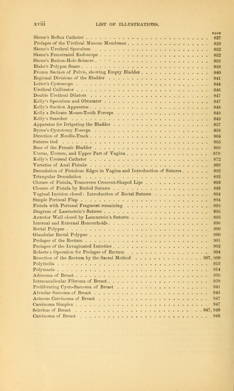 PAGE Skene's Reflux Catheter 827 Prolapse of the Urethral Mucous Memhrane 829 Skene's Urethral Speculum 832 Skene's Fenestrated Endoscope 832 Skene's Button-Hole Scissors . • • • 833 Blake's Polypus Snare 838 Frozen Section of Pelvis, showing Empty Bladder 840 Regional Divisions of the Bladder 841 Leiter's Cystoscope 844 Urethral Calibrator 846 Double Urethral Dilators 84 Kelly's Speculum and Obturator 847 Kelly's Suction Apparatus 848 Kelly's Delicate Mouse-Tooth Forceps 849 Kelly's Searcher 849 Apparatus for Irrigating the Bladder 857 Byrne's Cystotomy Forceps 859 Direction of Needle-Track 864 Sutures tied 865 Base of the Female Bladder 869 Uterus, Ureters, and Upper Part of Vagina 870 Kelly's Ureteral Catheter 872 Varieties of Anal Fistula? 889 Denudation of Fistulous Edges in Vagina and Introduction of Sutures 892 Triangular Denudation 892 Closure of Fistula, Transverse Crescent-Shaped Lips 893 Closure of Fistula by Buried Sutures 893 Vaginal Incision closed : Introduction of Rectal Sutures 894 Simple Perineal Flap 894 Fistula with Perineal Fragment remaining 895 Diagram of Lauenstein's Sutures 895 Anterior Wall closed by Lauenstein's Sutures 895 Internal and External Hemorrhoids 896 Rectal Polypus 900 Glandular Rectal Polypus 900 Prolapse of the Rectum 901 Prolapse of the Invaginated Intestine 902 Roberts's Operation for Prolapse of Rectum 904 Resection of the Rectum by the Sacral Method 907, 908 Polythelia 913 Polymazia 914 Adenoma of Breast 936 Intracanalicular Fibroma of Breast 938 Proliferating Cysto-Sarcoma of Breast 941 Alveolar Sarcoma of Breast 943 Acinous Carcinoma of Breast 947 Carcinoma Simplex 947 Scirrhus of Breast . . 947, 948 Carcinoma of Breast 948