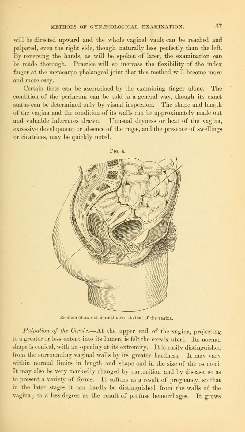 will be directed upward and the whole vaginal vault can be reached and palpated, even the right side, though naturally less perfectly than the left. By reversing the hands, as will be spoken of later, the examination can be made thorough. Practice will so increase the flexibility of the index finger at the metacarpophalangeal joint that this method will become more and more easy. Certain facts can be ascertained by the examining finger alone. The condition of the perineum can be told in a general way, though its exact status can be determined only by visual inspection. The shape and length of the vagina and the condition of its walls can be approximately made out and valuable inferences drawn. Unusual dryness or heat of the vagina, excessive development or absence of the ruga?, and the presence of swellings or cicatrices, may be quickly noted. Fia. 4. Relation of axis of normal uterus to that of the vagina. Palpation of the Cervix.—At the upper end of the vagina, projecting t< i a greater or less extent into its lumen, is felt the cervix uteri. Its normal shape is conical, with an opening at its extremity. It is easily distinguished from the surrounding vaginal walls by its greater hardness. It may vary within normal limits in length and shape and in the size of the os uteri. It may also lie very markedly changed by parturition and by disease, so as to present a variety of forms. It softens as a result of pregnancy, so that in the later stages it can hardly be distinguished from the walls of the vagina; to a less degree as the result of profuse hemorrhages. It grows