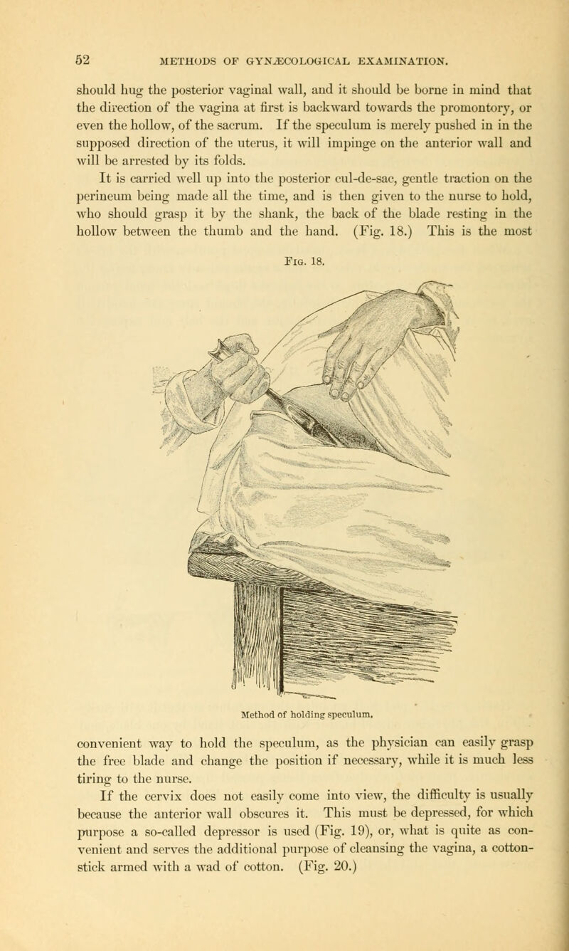 should hug the posterior vaginal wall, and it should be borne in mind that the direction of the vagina at first is backward towards the promontory, or even the hollow, of the sacrum. If the speculum is merely pushed in in the supposed direction of the uterus, it will impinge on the anterior wall and will be arrested by its folds. It is carried well up into the posterior cul-de-sac, gentle traction on the perineum being made all the time, and is then given to the nurse to hold, who should grasp it by the shank, the back of the blade resting in the hollow between the thumb and the hand. (Fig. 18.) This is the most Fig. 18. Method of holding speculum. convenient way to hold the speculum, as the physician can easily grasp the free blade and change the position if necessary, while it is much less tiring to the nurse. If the cervix does not easily come into view, the difficulty is usually because the anterior wall obscures it. This must be depressed, for which purpose a so-called depressor is used (Fig. 19), or, what is quite as con- venient and serves the additional purpose of cleansing the vagina, a cotton- stick armed with a wad of cotton. (Fig. 20.)