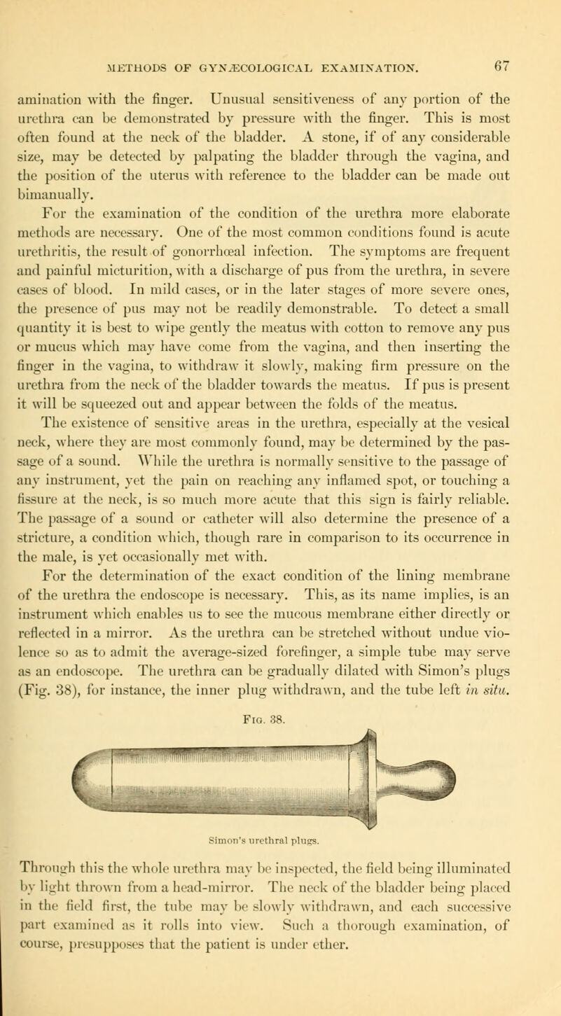 ami nation with the finger. Unusual sensitiveness of any portion of the urethra can be demonstrated by pressure with the finger. This is most often found at the neck of the bladder. A stone, if of any considerable size, may be detected by palpating the bladder through the vagina, and the position of the uterus with reference to the bladder can be made out bimanually. For the examination of the condition of the urethra more elaborate methods are necessary. One of the most common conditions found is acute urethritis, the result of gonorrheal infection. The symptoms are frequent and painful micturition, with a discharge of pus from the urethra, in severe - of blood. In mild cases, or in the later stages of more severe ones, the presence of pus may not be readily demonstrable. To detect a small quantity it is best to wipe gently the meatus with cotton to remove any pus or mucus which may have come from the vagina, and then inserting the finger in the vagina, to withdraw it slowly, making firm pressure on the urethra from the neck of the bladder towards the meatus. If pus is present it will be squeezed out and appear between the folds of the meatus. The existence of sensitive areas in the urethra, especially at the vesical neck, where they are most commonly found, may be determined by the pas- sage of a sound. While the urethra is normally sensitive to the passage of any instrument, yet the pain on reaching any inflamed spot, or touching a Assure at the neck, is so much more acute that this sign is fairly reliable. The passage of a sound or catheter will also determine the presence of a stricture, a condition which, though rare in comparison to its occurrence in the male, is yet occasionally met with. For the determination of the exact condition of the lining membrane of the urethra the endoscope is necessary. This, as its name implies, is an instrument which enables us to see the mucous membrane either directly or reflected in a mirror. As the urethra can be stretched without undue vio- lence so as to admit the average-sized forefinger, a simple tube may serve as an endoscope. The urethra can be gradually dilated with Simon's plugs (Fig. 38), for instance, the inner plug withdrawn, and the tube left in situ. Fig. 38. Simon's urethral plugs. Through this the whole urethra may be Inspected, the field being illuminated by light thrown from a head-mirror. The neck of the bladder being placed in the field first, the tube may be slowly withdrawn, and each successive part examined as it rolls into view. Such a thorough examination, of course, presupposes that the patient is under ether.