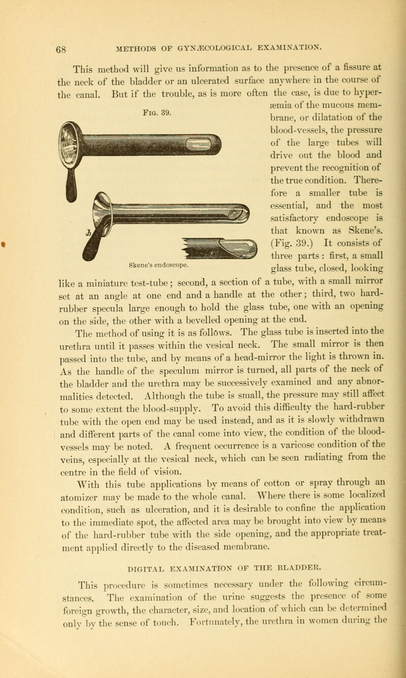 Fig. 39. Skene's endoscope. This method will give us information as to the presence of a fissure at the neck of the bladder or an ulcerated surface anywhere in the course of the canal. But if the trouble, as is more often the case, is due to hyper- aemia of the mucous mem- brane, or dilatation of the blood-vessels, the pressure of the large tubes will drive out the blood and prevent the recognition of the true condition. There- fore a smaller tube is essential, and the most satisfactory endoscope is that known as Skene's. (Fig. 39.) It consists of three parts : first, a small glass tube, closed, looking like a miniature test-tube; second, a section of a tube, with a small mirror set at an angle at one end and a handle at the other; third, two hard- rubber specula large enough to hold the glass tube, one with an opening on the side, the other with a bevelled opening at the end. The method of using it is as follows. The glass tube is inserted into the urethra until it passes within the vesical neck. The small mirror is then passed into the tube, and by means of a head-mirror the light is thrown in. As the handle of the speculum mirror is turned, all parts of the neck of the bladder and the urethra may be successively examined and any abnor- malities detected. Although the tube is small, the pressure may still affect to some extent the blood-supply. To avoid this difficulty the hard-rubber tube with the open end may be used instead, and as it is slowly withdrawn and different parts of the canal come into view, the condition of the blood- vessels may be noted. A frequent occurrence is a varicose condition of the veins, especially at the vesical neck, which can be seen radiating from the centre in the field of vision. With this tube applications by means of cotton or spray through an atomizer may be made to the whole canal. Where there is some localized condition, such as ulceration, and it is desirable to confine the application to the immediate spot, the affected area may be brought into view by means of the hard-rubber tube with the side opening, and the appropriate treat- ment applied directly to the diseased membrane. DIGITAL EXAMINATION OF THE BLADDER. This procedure is sometimes necessary under the following circum- stances. The examination of the urine suggests the presence of some foreign growth, the character, size, and location of which can be determined only by the sense of touch. Fortunately, the urethra in women during the