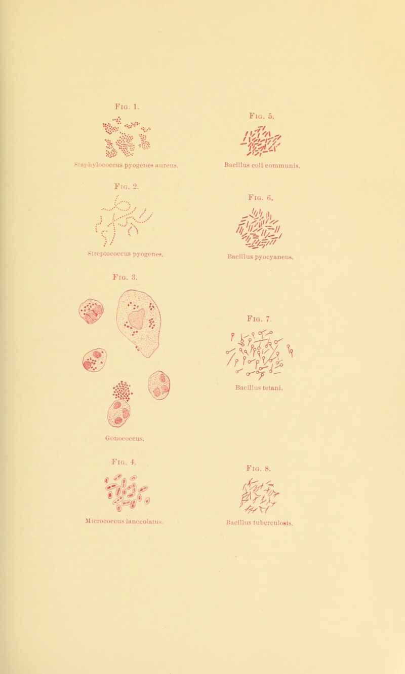 <taphyl< !•' ... 2. Fig Pig. 5. Bacillus eoli communis. Fig. 6. Bacillus pyocyaneus. Pig. 7. cry ■ tetani. Fig. I. tmc is lanceolatus Fig. 8. Phi 4/x-f r Bacillus tubi