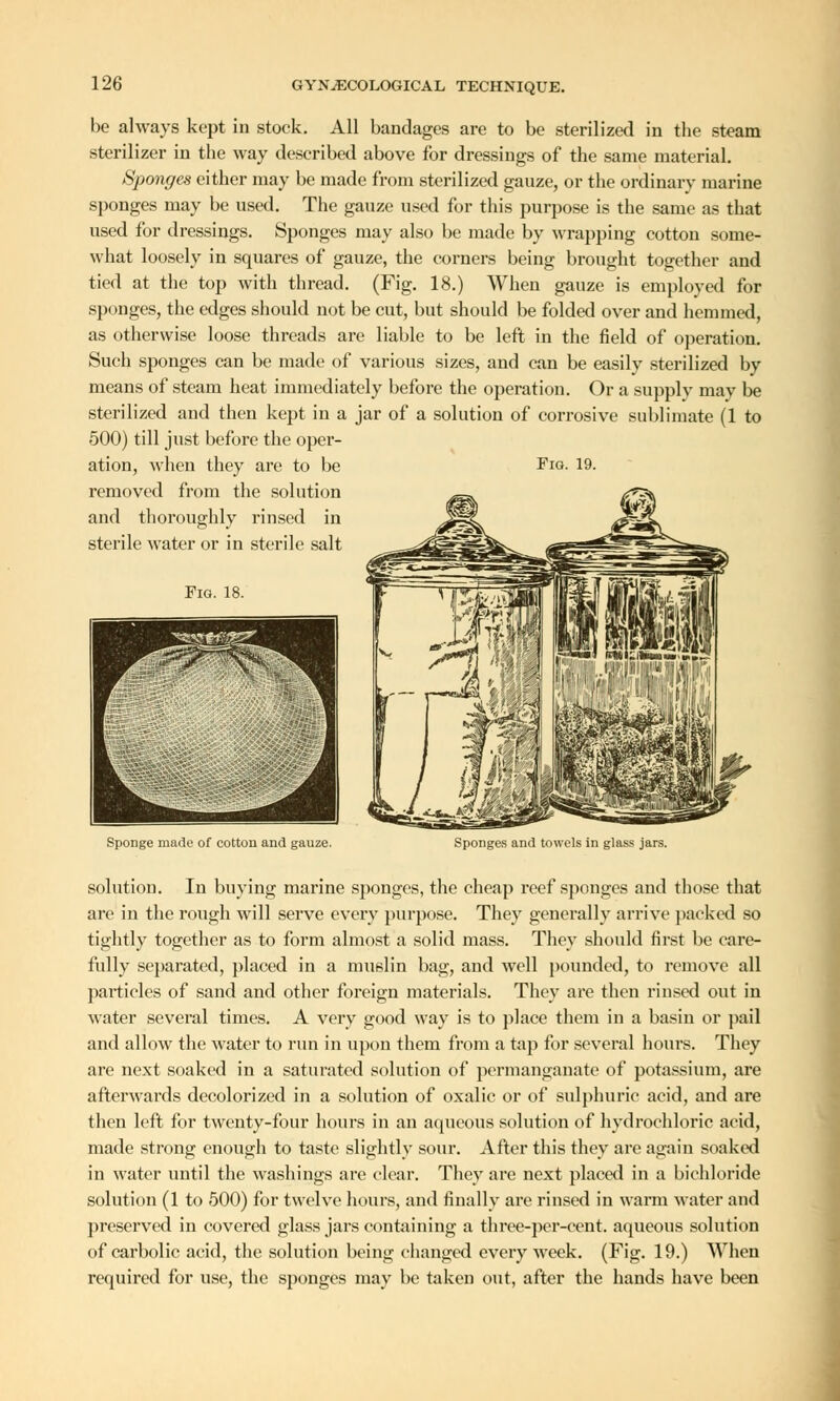 be always kept in stock. All bandages are to be sterilized in the steam sterilizer in the way described above for dressings of the same material. Sponges either may be made from sterilized gauze, or the ordinary marine sponges may be used. The gauze used for this purpose is the same as that used for dressings. Sponges may also be made by wrapping cotton some- what loosely in squares of gauze, the corners being brought together and tied at the top with thread. (Fig. 18.) When gauze is employed for sponges, the edges should not be cut, but should be folded over and hemmed, as otherwise loose threads are liable to be left in the field of operation. Such sponges can be made of various sizes, and can be easily sterilized by means of steam heat immediately before the operation. Or a supply may be sterilized and then kept in a jar of a solution of corrosive sublimate (1 to 500) till just before the oper- ation, when they are to be Fig. 19. removed from the solution and thoroughly rinsed in sterile water or in sterile salt Sponge made of cotton and gauze. Sponges and towels in glass jars. solution. In buying marine sponges, the cheap reef sponges and those that are in the rough will serve every purpose. They generally arrive packed so tightly together as to form almost a solid mass. They should first be care- fully separated, placed in a muslin bag, and well pounded, to remove all particles of sand and other foreign materials. They are then rinsed out in water several times. A very good way is to place them in a basin or pail and allow the water to run in upon them from a tap for several hours. They are next soaked in a saturated solution of permanganate of potassium, are afterwards decolorized in a solution of oxalic or of sulphuric acid, and are then left for twenty-four hours in an aqueous solution of hydrochloric acid, made strong enough to taste slightly sour. After this they are again soaked in water until the washings are clear. They are next placed in a bichloride solution (1 to 500) for twelve hours, and finally are rinsed in warm water and preserved in covered glass jars containing a three-per-ccnt. aqueous solution of carbolic acid, the solution being changed every week. (Fig. 19.) When required for use, the sponges may be taken out, after the hands have been