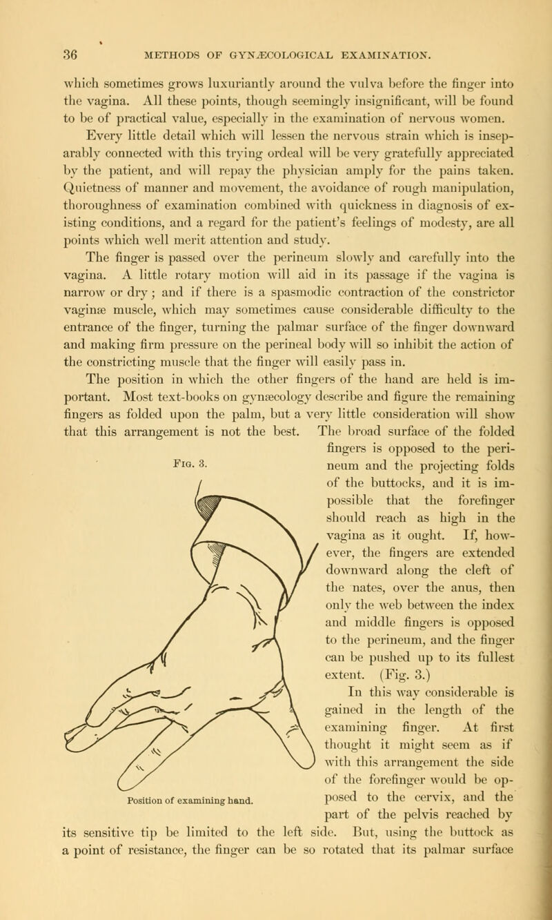 which sometimes grows luxuriantly around the vulva before the finger into the vagina. All these points, though seemingly insignificant, will be found to be of practical value, especially in the examination of nervous Avomen. Every little detail which will lessen the nervous strain which is insep- arably connected with this trying ordeal will be very gratefully appreciated by the patient, and will repay the physician amply for the pains taken. Quietness of manner and movement, the avoidance of rough manipulation, thoroughness of examination combined with quickness in diagnosis of ex- isting conditions, and a regard for the patient's feelings of modesty, are all points which well merit attention and study. The finger is passed over the perineum slowly and carefully into the vagina. A little rotary motion will aid in its passage if the vagina is narrow or dry; and if there is a spasmodic contraction of the constrictor vagina? muscle, which may sometimes cause considerable difficulty to the entrance of the finger, turning the palmar surface of the finger downward and making firm pressure on the perineal body will so inhibit the action of the constricting muscle that the finger will easily pass in. The position in which the other fingers of the hand are held is im- portant. Most text-books on gynaecology describe and figure the remaining fingers as folded upon the palm, but a very little consideration will show that this arrangement is not the best. The broad surface of the folded fingers is opposed to the peri- Fro- 3- neum and the projecting folds of the buttocks, and it is im- possible that the forefinger should reach as high in the vagina as it ought. If, how- ever, the fingers are extended downward along the cleft of the nates, over the anus, then only the web between the index and middle fingers is opposed to the perineum, and the finger can be pushed up to its fullest extent. (Fig. 3.) In this way considerable is gained in the length of the examining finger. At first thought it might seem as if with this arrangement the side of the forefinger would be op- posed to the cervix, and the part of the pelvis reached by its sensitive tip be limited to the left side. But, using the buttock as a point of resistance, the finger can be so rotated that its palmar surface Position of examining hand.