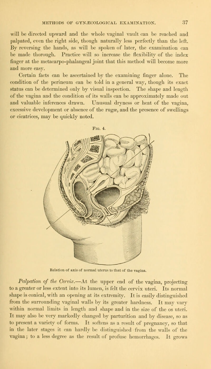 will be directed upward and the whole vaginal vault can be reached and palpated, even the right side, though naturally less perfectly than the left. By reversing the hands, as will be spoken of later, the examination can be made thorough. Practice will so increase the flexibility of the index finger at the metacarpo-phalangeal joint that this method will become more and more easy. Certain facts can be ascertained by the examining finger alone. The condition of the perineum can be told in a general way, though its exact status can be determined only by visual inspection. The shape and length of the vagina and the condition of its walls can be approximately made out and valuable inferences drawn. Unusual dryness or heat of the vagina, excessive development or absence of the rugae, and the presence of swellings or cicatrices, may be quickly noted. Fig. 4. Relation of axis of normal uterus to that of the vagina. Palpation of the Cervix.—At the upper end of the vagina, projecting to a greater or less extent into its lumen, is felt the cervix uteri. Its normal shape is conical, with an opening at its extremity. It is easily distinguished from the surrounding vaginal walls by its greater hardness. It may vary within normal limits in length and shape and in the size of the os uteri. It may also be very markedly changed by parturition and by disease, so as to present a variety of forms. It softens as a result of pregnancy, so that in the later stages it can hardly lie distinguished from the walls of the vagina; to a less degree as the result of profuse hemorrhages. It grows