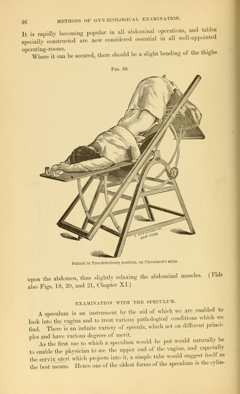 It is rapidly becoming popular in all abdominal operations and tables specially constructed are now considered essential in all well-appointed 0PeW^T^i be secured, there should be a slight bending of the thighs Fig. 10. Patient in Trendelenburg position, on Cleveland's table. upon the abdomen, thus slightly relaxing the abdominal muscles. (Vide also Figs. 19, 20, and 21, Chapter XI.) EXAMINATION WITH THE SPECULUM. A speculum is an instrument by the aid of which we are enabled to look into the vagina and to treat various pathological conditions which we find. There is an infinite variety of specula, which act on different princi- ples and have various degrees of merit. As the first use to which a speculum would be put would naturally be to enable the physician to see the upper end of the vagina, and espgcially the cervix uteri which projects into it, a simple tube would suggest itself as the best means. Hence one of the oldest forms of the speculum is the cylm-