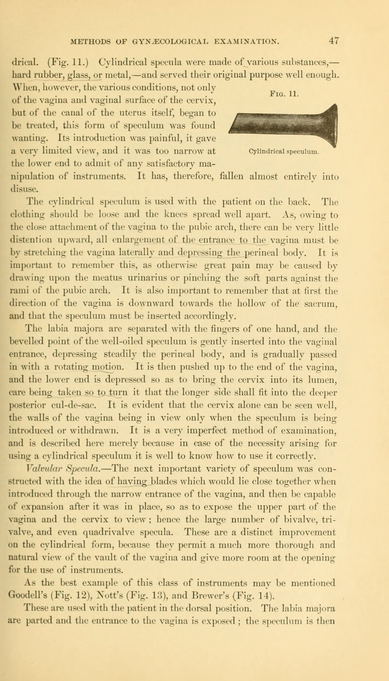 drical. (Fig. 11.) Cylindrical specula were made of various substances,— bard rubber, glass, or metal,—and served their original purpose well enough. When, however, the various conditions, not only of the vagina and vaginal surface of the cervix, but of the canal of the uterus itself, began to be treated, this form of speculum was found wanting. Its introduction was painful, it gave a very limited view, and it was too narrow at Cylindrical speculum. the lower end to admit of any satisfactory ma- nipulation of instruments. It has, therefore, fallen almost entirely into disuse. The cylindrical speculum is used with the patient on the back. The clothing should be loose and the knees spread well apart. As, owing to the close attachment of the vagina to the pubic arch, there can be very little distention upward, all enlargement of the entrance to the vagina must be by stretching the vagina laterally and depressing the perineal body. It is important to remember this, as otherwise great pain may be caused by drawing upon the meatus urinarius or pinching the soft parts against the rami of the pubic arch. It is also important to remember that at first the direction of the vagina is downward towards the hollow of the sacrum, and that the speculum must be inserted accordingly. The labia majora are separated with the fingers of one hand, and the bevelled point of the well-oiled speculum is gently inserted into the vaginal entrance, depressing steadily the perineal body, and is gradually passed in with a rotating motion. It is then pushed up to the end of the vagina, and the lower end is depressed so as to bring the cervix into its lumen, care being taken so to turn it that the longer side shall fit into the deeper posterior cul-de-sac. It is evident that the cervix alone can be seen well, the walls of the vagina being in view only when the speculum is being introduced or withdrawn. It is a very imperfect method of examination, and is described here merely because in case of the necessity arising for using a cylindrical speculum it is well to know how to use it correctly. Valvular Specula.—The next important variety of speculum was con- structed with the idea of having blades which would lie close together when introduced through the narrow entrance of the vagina, and then be capable of expansion after it was in place, so as to expose the upper part of the vagina and the cervix to view ; hence the large number of bivalve, tri- valve, and even quadrivalve specula. These are a distinct improvement on the cylindrical form, because they permit a much more thorough and natural view of the vault of the vagina and give more room at the opening for the use of instruments. As the best example of this class of instruments may be mentioned Goodell's (Fig. 12), Xott's (Fig. 1:5), and Brewer's (Fig. 14). These are used with the patient in the dorsal position. The labia majora are parted and the entrance to the vagina is exposed ; the speculum is then