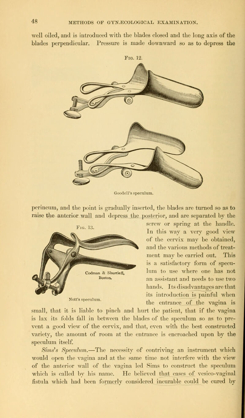 well oiled, and is introduced with the blades closed and the long axis of the blades perpendicular. Pressure is made downward so as to depress the Fia. 12. Goodell's speculum. perineum, and the point is gradually inserted, the blades are turned so as to raise the anterior wall and depress the posterior, and are separated by the screw or spring at the handle. Fig. 13. T i • , ■ In tins way a very good view of the cervix may be obtained, and the various methods of treat- ment may be carried out. This is a satisfactory form of specu- lum to use where one has not an assistant and needs to use two hands. Its disadvantages are that its introduction is painful when the entrance of the vagina is small, that it is liable to pinch and hurt the patient, that if the vagina is lax its folds fall in between the blades of the speculum so as to pre- vent a good view of the cervix, and that, even with the best constructed variety, the amount of room at the entrance is encroached upon by the speculum itself. Sims's Speculum.—The necessity of contriving an instrument which would open the vagina and at the same time not interfere with the view of the anterior wall of the vagina led Sims to construct the speculum which is called by his name. He believed that eases of vesico-vaginal fistula which had been formerly considered incurable could be cured by Nott's speculum.