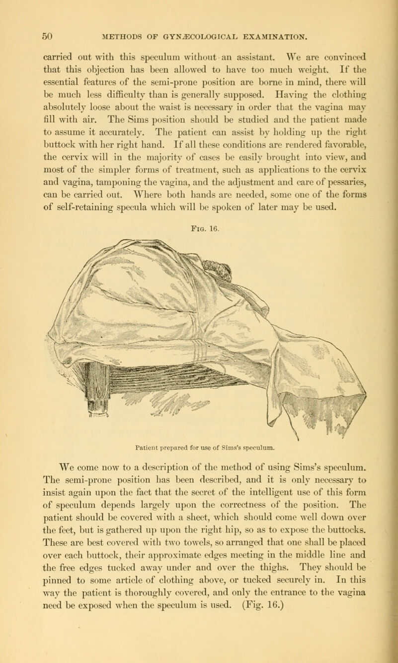 carried out with this speculum without an assistant. We are convinced that this objection has been allowed to have too much weight. If the essential features of the semi-prone position are borne in mind, there will be much less difficulty than is generally supposed. Having the clothing absolutely loose about the waist is necessary in order that the vagina may fill with air. The Sims position should be studied and the patient made to assume it accurately. The patient can assist by holding up the right buttock with her right hand. If all these conditions arc rendered favorable, the cervix will in the majority of cases be easily brought into view, and most of the simpler forms of treatment, such as applications to the cervix and vagina, tamponing the vagina, and the adjustment and care of pessaries, can be carried out. Where both hands are needed, some one of the forms of self-retaining specula which will be spoken of later may be used. Fig. 16. Patient prepared for use of Pims's speculum. We come now to a description of the method of using Sims's speeulum. The semi-prone position has been described, and it is only necessary to insist again upon the fact that the secret of the intelligent use of this form of speeulum depends largely upon the correctness of the position. The patient should be covered with a sheet, which should come well down over the feet, but is gathered up upon the right hip, so as to expose the buttocks. These are best covered with two towels, so arranged that one shall be placed over each buttock, their approximate edges meeting in the middle line and the free edges tucked away under and over the thighs. They should be pinned to some article of clothing above, or tucked securely in. In this way the patient is thoroughly covered, and only the entrance to the vagina need be exposed when the speculum is used. (Fig. 16.)
