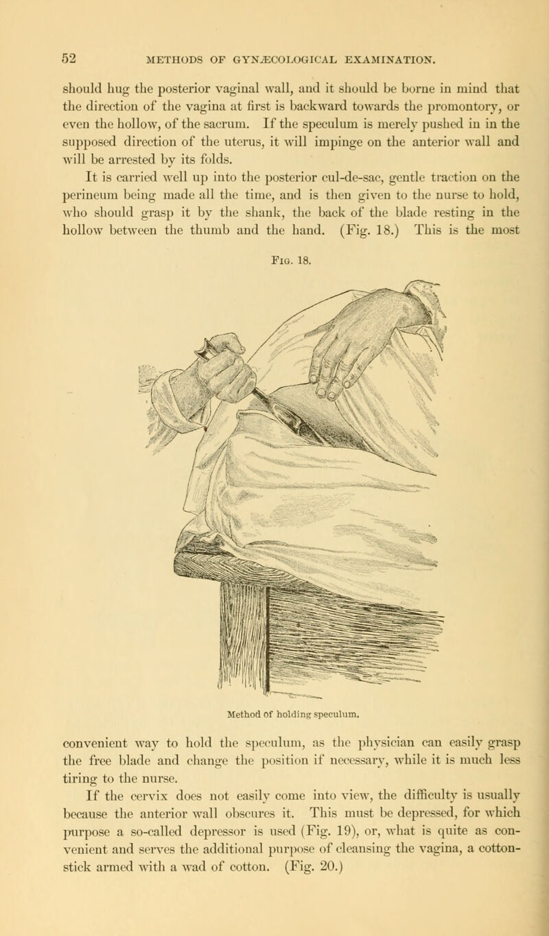 should hug the posterior vaginal wall, and it should be borne in mind that the direction of the vagina at first is backward towards the promontory, or even the hollow, of the sacrum. If the speculum is merely pushed in in the supposed direction of the uterus, it will impinge on the anterior wall and will be arrested by its folds. It is carried well up into the posterior cul-de-sac, gentle traction on the perineum being made all the time, and is then given to the nurse to hold, who should grasp it by the shank, the back of the blade resting in the hollow between the thumb and the hand. (Fig. 18.) This is the most Fig. 18. Method Of holding speculum. convenient way to hold the speculum, as the physician can easily grasp the free blade and change the position if necessary, while it is much less tiring to the nurse. If the cervix does not easily come into view, the difficulty is usually because the anterior wall obscures it. This must be depressed, for which purpose a so-called depressor is used (Fig. 19), or, what is quite as con- venient and serves the additional purpose of cleansing the vagina, a cotton- stick armed with a wad of cotton. (Fig. 20.)