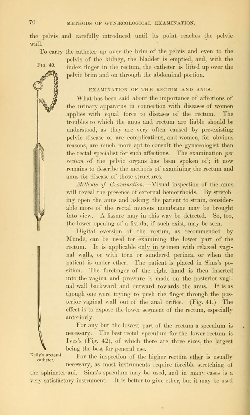 the pelvis and carefully introduced until its point reaches the pelvic wall. To carry the catheter up over the brim of the pelvis and even to the pelvis of the kidney, the bladder is emptied, and, with the index finger in the rectum, the catheter is lifted up over the pelvic brim and on through the abdominal portion. Fig. 40. EXAMINATION OF THE RECTUM AND ANUS. What has been said about the importance of affections of the urinary apparatus in connection with diseases of women applies with equal force to diseases of the rectum. The troubles to which the anus and rectum are liable should be understood, as they are very often caused by pre-existing pelvic disease or are complications, and women, for obvious reasons, are much more apt to consult the gynaecologist than the rectal specialist for such affections. The examination per rectum of the pelvic organs has been spoken of; it now remains to describe the methods of examining the rectum and anus for disease of those structures. Methods of Examination.—Visual inspection of the anus will reveal the presence of external hemorrhoids. By stretch- ing open the anus and asking the patient to strain, consider- able more of the rectal mucous membrane may be brought into view. A fissure may in this way be detected. So, too, the lower opening of a fistula, if such exist, may be seen. Digital eversion of the rectum, as recommended by Munde, can be used for examining the lower part of the rectum. It is applicable only in women with relaxed vagi- nal walls, or with torn or sundered perinea, or when the patient is under ether. The patient is placed in Sims's po- sition. The forefinger of the right hand is then inserted into the vagina and pressure is made on the posterior vagi- nal wall backward and outward towards the anus. It is as though one were trying to push the finger through the pos- terior vaginal wall out of the anal orifice. (Fig. 41.) The effect is to expose the lower segment of the rectum, especially anteriorly. For any but the lowest part of the rectum a speculum is necessary. The best rectal speculum for the lower rectum is Ives's (Fig. 42), of which there are three sizes, the largest being the best for general use. For the inspection of the higher rectum ether is usually necessary, as most instruments require forcible stretching of the sphincter ani. Sims's speculum may be used, and in many eases is a very satisfactory instrument. It is better to give ether, but it may be used Kelly's ureteral catheter.