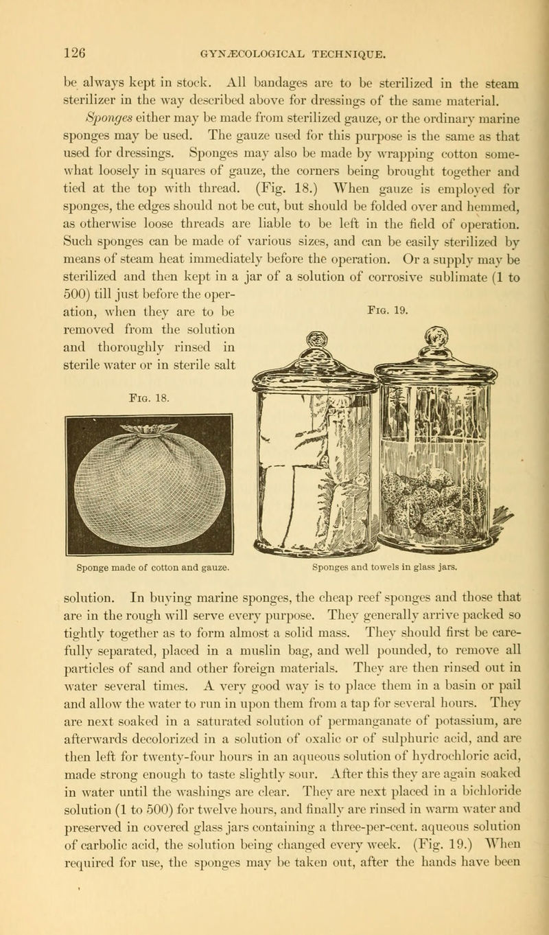 be always kept in stock. All bandages are to be sterilized in the steam sterilizer in the way described above for dressings of the same material. Sponges either may be made from sterilized gauze, or the ordinary marine sponges may be used. The gauze used for this purpose is the same as that used for dressings. Sponges may also be made by wrapping cotton some- what loosely in squares of gauze, the corners being brought together and tied at the top with thread. (Fig. 18.) When gauze is employed for sponges, the edges should not be cut, but should be folded oyer and hemmed, as otherwise loose threads are liable to be left in the field of operation. Such sponges can be made of various sizes, and can be easily sterilized by means of steam heat immediately before the operation. Or a supply may be sterilized and then kept in a jar of a solution of corrosive sublimate (1 to 500) till just before the oper- ation, when they are to be Fig. 19. removed from the solution and thoroughly rinsed in sterile water or in sterile salt Fig. 18 Sponge made of cotton and gauze. Sponges and towels in glass jars. solution. In buying marine sponges, the cheap reef sponges and those that are in the rough will serve every purpose. They generally arrive packed so tightly together as to form almost a solid mass. They should first be care- fully separated, placed in a muslin bag, and well pounded, to remove all particles of sand and other foreign materials. They are then rinsed out in water several times. A very good way is to place them in a basin or pail and allow the water to run in upon them from a tap for several hours. They are next soaked in a saturated solution of permanganate of potassium, are afterwards decolorized in a solution of oxalic or of sulphuric acid, and are then left for twenty-four hours in an aqueous solution of hydrochloric acid, made strong enough to taste slightly sour. After this they are again soaked in water until the washings are clear. They are next placed in a bichloride solution (1 to 500) for twelve hours, and finally are rinsed in warm water and preserved in covered glass jars containing a three-per-cent. aqueous solution of carbolic acid, the solution being changed every week. (Fig. 19.) When required for use, the sponges may be taken out, after the hands have been