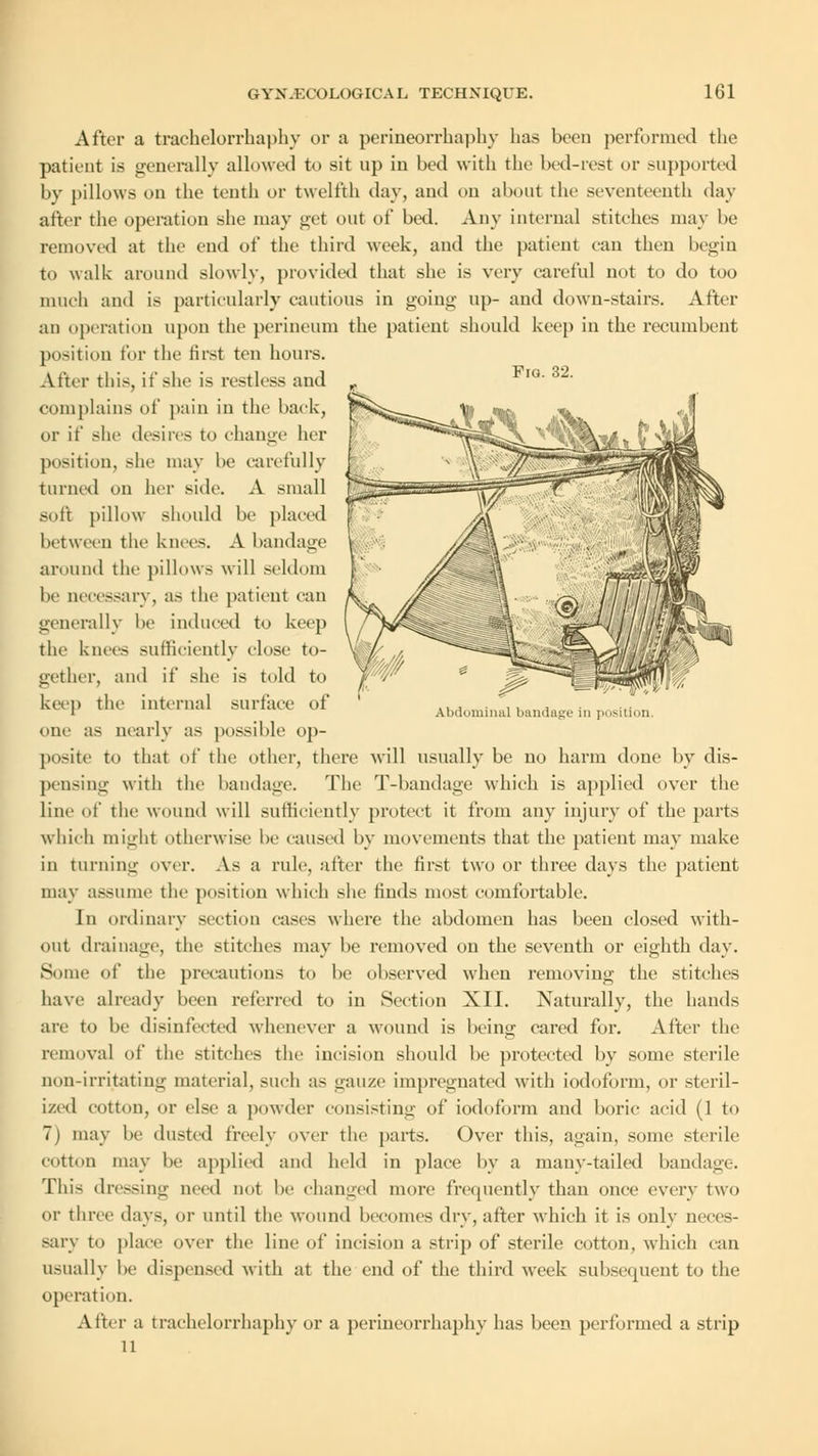 Fro. 32. Abdominal bandage in position After a trachelorrhaphy or a perineorrhaphy has been performed the patient is generally allowed to sit up in bed with the bed-res! or supported by pillows on the tenth or twelfth day, and on about the seventeenth day after the operation she may get out of bed. Any internal stitches may be removed at the end of the third week, and the patient ean then begin to walk around slowly, provided that she is very careful not to do too much and is particularly cautious in going up- and down-stairs. After an operation upon the perineum the patient should keep in the recumbent position for the first ten hours. After this, if she is restless and complains of pain in the back, or if she desires to change her position, she may be carefully turned on her side. A small soft pillow should be placed between the knees. A bandage around the pillows will seldom be necessary, as the patient can generally be induced to keep the knees sufficiently close to- gether, and if she is told to keep the internal surface of one as nearly as possible op- posite to that of the other, there will usually be no harm done by dis- pensing with the bandage. The T-bandage which is applied over the line of the wound will sufficiently protect it from any injury of the parts which might otherwise be caused by movements that the patient may make in turning over. As a rule, after the first two or three days the patient may assume the position which she finds most comfortable. In ordinary section eases where the abdomen has been closed with- out drainage, the stitches may be removed on the seventh or eighth day. Some of the precautions to be observed when removing the stitches have already been referred to in Section XII. Naturally, the hands are to be disinfected whenever a wound is being eared for. After the removal of the stitches the incision should be protected by some sterile non-irritating material, such as gauze impregnated with iodoform, or steril- ized cotton, i' else a powder consisting of iodoform and boric acid (1 to 7) may be dusted freely over the parts. Over this, again, some sterile cotton may lie applied and held in place by a many-tailed bandage. This dressing need not be changed more frequently than once every two or three days, or until the wound becomes dry, after which it is only neces- sary to place over the line of incision a strip of sterile cotton, which can usually be dispensed with at the end of the third week subsequent to the operation. After a trachelorrhaphy or a perineorrhaphy has been performed a strip 11
