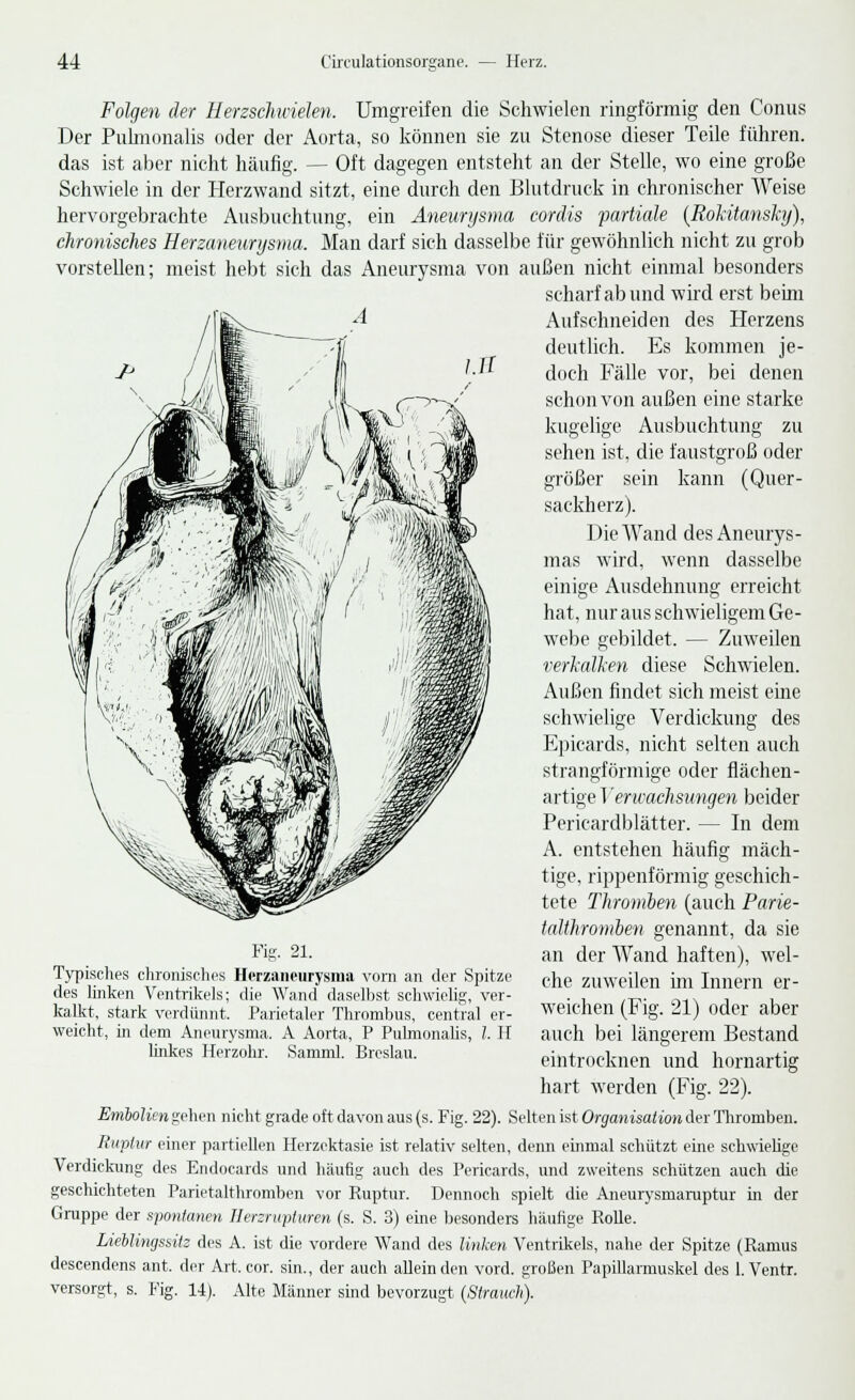 Folgen der Herzschwielen. Umgreifen die Schwielen ringförmig den Conus Der Pulmonalis oder der Aorta, so können sie zu Stenose dieser Teile führen, das ist aber nicht häufig. — Oft dagegen entsteht an der Stelle, wo eine große Schwiele in der Herzwand sitzt, eine durch den Blutdruck in chronischer Weise hervorgebrachte Ausbuchtung, ein Aneurysma cordis partiale (Rokitansky), chronisches Herzaneurysma. Man darf sich dasselbe für gewöhnlich nicht zu grob vorstellen; meist hebt sich das Aneurysma von außen nicht einmal besonders scharf ab und wird erst beim A Aufschneiden des Herzens deutlich. Es kommen je- doch Fälle vor, bei denen schon von außen eine starke kugelige Ausbuchtung zu sehen ist, die faustgroß oder größer sein kann (Quer- sackherz). Die Wand des Aneurys- mas wird, wenn dasselbe einige Ausdehnung erreicht hat, nur aus schwieligem Ge- webe gebildet. — Zuweilen verkalken diese Schwielen. Außen findet sich meist eine schwielige Verdickung des Epicards, nicht selten auch strangförmige oder flächen- artige T 'encacJisungen beider Pericardblätter. — In dem A. entstehen häufig mäch- tige, rippenförmig geschich- tete Thromben (auch Parie- talthromoen genannt, da sie an der Wand haften), wel- che zuweilen im Innern er- weichen (Fig. 21) oder aber auch bei längerem Bestand eintrocknen und hornartig hart werden (Fig. 22). Embolien gehen nicht grade oft davon aus (s. Fig. 22). Selten ist Organisation der Thromben. Ruptur einer partiellen Herzektasie ist relativ selten, denn einmal schützt eine schwielige Verdickung des Endocards und häufig auch des Pericards, und zweitens schützen auch die geschichteten Parietalthromben vor Ruptur. Dennoch spielt die Aneurysmaruptur in der Gruppe der spontanen Ilerzrupturen (s. S. 3) eine besonders häufige Rolle. Lieblingssitz des A. ist die vordere Wand des linken Ventrikels, nahe der Spitze (Ramus descendens ant. der Art, cor. sin., der auch allein den vord. großen Papillarmuskel des 1. Ventr. versorgt, s. Fig. 14). Alte Männer sind bevorzugt (Strauch). Fig. 21. Typisches chronisches Herzaneurysma vorn an der Spitze des linken Ventrikels; die Wand daselbst, schwielig, ver- kalkt, stark verdünnt. Parietaler Thrombus, central er- weicht, in dem Aneurysma. A Aorta, P Pulmonalis, l. II linkes Herzohr. Samml. Breslau.
