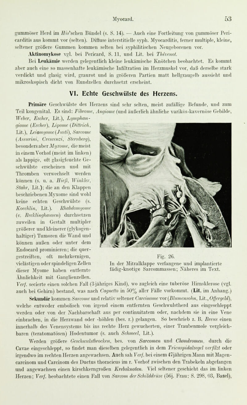 gummöser Herd im ffis'schen Bündel (s. S. 14). — Auch eine Fortleitung von gummöser Peri- carditis aus kommt vor (selten). Diffuse interstitielle syph. Myocarditis, ferner multiple, kleine, seltener größere Gummen kommen selten bei syphilitischen Neugeborenen vor. Aktinomykose vgl. bei Pericard, S. 11, und Lit. bei Thivenot. Bei Leukämie werden gelegentlich kleine leukämische Knötchen beobachtet. Es kommt aber auch eine so massenhafte leukämische Infiltration im Herzmuskel vor, daß derselbe stark verdickt und glasig wird, graurot und in größeren Partien matt hellgraugelb aussiebt und mikroskopisch dicht von Rundzellen durchsetzt erscheint. VI. Echte Geschwülste des Herzens. Primäre Geschwülste des Herzens sind sehr selten, meist zufällige Befunde, und zum Teil kongenital. Es sind: Fibrome, Angiome (und äußerlich ähnliche varikös-kavernöse Gebilde, Weber, Escher, Lit.), Lymphan- giome (Escher), Lipome (Dittrich, Lit.), Leiomyome (Justi), Sarcome (Assurini, Creseemi, Slemberg), besonders aber Myxome, die meist in einem Vorhof (meist im linken) als lappige, oft glasigfeuchte Ge- schwülste erscheinen und mit Thromben verwechselt werden können (s. u. a. Hieß, Wvhkler, Stahr, Lit.); die an den Klappen beschriebenen Myxome sind wohl keine echten Geschwülste (s. Koechlin, Lit.). Rhäbäomyome (v. Recklinghausen) durchsetzen zuweilen in Gestalt multipler größerer und kleinerer (glykogen- haltiger) Tumoren die Wand und können außen oder unter dem Endoeard prominieren; die quer- gestreiften, oft mehrkernigen, vielästigen oder spindeligen Zellen dieser Myome haben entfernte Ähnlichkeit mit Ganglienzellen. Verf. seeierte einen solchen Fall (3 jähriges Kind), wo zugleich eine tuberöse Hirnsklerose (vgl. auch bei Gehirn) bestand, was nach Cagnello in 50% aller Fälle vorkommt. (Lit, im Anhang.) Sekundär kommen Sarcome und relativ seltener Carcinome vor (Blumensohn, Lit., Offergeid), welche entweder embolisch von irgend einem entfernten Geschwulstherd aus eingeschleppt werden oder von der Nachbarschaft aus per continuitatem oder, nachdem sie in eine Vene einbrachen, in die Herzwand oder -höhlen (bes. r.) gelangen. So beschrieb z. B. Breus einen innerhalb des Venensystems bis ins rechte Herz gewucherten, einer Traubenmole vergleich- baren (teratomatösen) Hodentumor (s. auch Schmeel, Lit.). Werden größere Geschwulstbrocken, bes. von Sarcomen und Chondromen, durch die Cavae eingeschleppt, so findet man dieselben gelegentlich in dem Tricuspidalsegel verfilzt oder irgendwo im rechten Herzen angewachsen. Auch sah Verf. bei einem 47jährigen Mann mit Magen- carcinom und Carcmom des Ductus thoracicus im r. Vorhof zwischen den Trabekeln abgefangen und angewachsen einen kirschkerngroßen Krebsknoten. Viel seltener geschieht das im linken Herzen; Verf. beobachtete einen Fall von Sarcom der Schilddrüse (Ö6j. Frau: S. 298, U3, Basel), Fig. 26. In der Mitralklappe verfangene und implantierte fädig-knotige Sarcommassen; Näheres im Text.