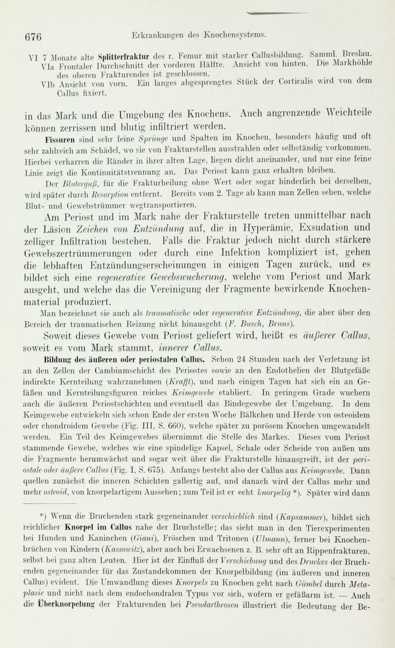 g76 Erlaaiikuiigen di's Knochcnsystems. VI 7 Monate alte Splifterfraktiir des r. Feimir mit starker Callusbilduiig. Samml. Breslau. Via Frontaler Diirclisclmitt der vorderen Hiilfte. Ansicht von hinten. Die Markhohle des oberen Frakturendes ist geschlossen. , . , Vlb Ansiclit von vorn. Ein langes abgesprengtes Stück der Corticalis wird von dem Callus fixiert. in das Mark und die UiiiKebuiig dos Knochens. Aneh angrenzende Weichteile können zerrissen und blutig infiltriert werden. Fissuren sind sehr feine Sprünge und Spalten im Knochen, besonders häufig und oft sehr zahlreich am Schädel, wo sie von Frakturstellen ausstrahlen oder selbständig vorkommen. Hierbei verharren die Ränder in ihrer alten Lage, liegen dicht aneinander, und nur eine feine Linie zeigt die Kontinuitätstrennung an. Das Periost kann ganz erhalten bleilien. Der Bhiimjuß, für die Frakturheilung ohne Wert oder sogar hinderlich bei derselben, wii-d später durch Resorption entfernt. Bereits vom 2. Tage ab kann man Zellen sehen, welche Blut- und Gewebstrümmer wegtransportieren. Am Periost und im Mark nahe der Frakturstelle treten unmittelbar nach der Läsion Zeichen von Entzündung auf. die in lT}'])eräinie, Exsudation und zelliger Infiltration bestehen. Falls die Fraktur jedoch nicht durch stärkere Gewebszertrümmerungen oder durch eine Infektion kompliziert ist, gehen die lebhaften Entzündungserscheinungen in einigen Tagen zurück, und es bildet sich eine regenerative Getceiswucherung, welche vom Periost und Mark ausgeht, und welche das die Vereinigiuig der Fragmente bewirkende Knochen- material produziert. Man bezeichnet sie auch als traimuäischc oder regenerative Entzündung, die aber über den Bereich der traumatischen Reizung nicht hinausgeht (F. Busch, Bruns). Soweit dieses Gewebe vom Periost geliefert wird, heißt es äußerer Callus, soweit es vom Mark stammt, innerer Callus. Bildiiiig (Ips äußeren oder jierinstalon Callus. Schon 24 Stunden nach der Verletzung ist an den Zellen der Camtiiunischicht des Peri(jstes sowie an den Endothelien der Blutgefäße indirekte Kernteilung wahrzunehmen (Krafjt), und nach einigen Tagen hat sich ein an Ge- fäßen und Kernteilungsfiguren reiches Keimgewebe etabliert. In geringem Grade wuchern auch die äußeren Periostschichten und eventuell das Bindegewebe der Umgebung. In dem Keimgewebe entwickeln sich schon Ende der ersten Woche Bälkchen und Herde von osteoidem oder cliondroidem Gewelje (Fig. III, S. 660), welche später zu porösem Ivnochen umgewandelt werden. Em Teil des Keimgewebes übernimmt die Stelle des Markes. Dieses vom Periost stammende Gewebe, welches wie eine spindelige Kapsel, Schale oder Scheide von außen um die Fragmente herumwächst imd sogar weit über die Frakturstelle hinausgreift, ist der peri- ostale oder äußere Callus (Fig. I, S. 675). Anfangs besteht also der Callus aus Keimgewele. Dann quellen zunächst die inneren Schichten gallertig auf, und danach wird der Callus mehr und mehr osteoid, von knorpelartigem Aussehen; zum Teil ist er echt hiorpelig *). Später wud dann *) \\enn die Bruchenden stark gegeneinander verschieblich sind (Kapsammer), bildet sich reichlichci- Knorpel im Callus nahe der BmchsteUe; das sieht man in den Tierexperiinenten bei Hunden und Kaninchen (Giani), Fröschen und Trifolien {Ulnmnn), ferner bei Knochen- brüchen von Kindern (Kassowitz), aber auch bei Erwachsenen z. B. sehr oft an Rippenfraktmen. selbst bei ganz alten Leuten. Hier ist der Einfluß der Verschiebung und des Druckes der Bruch- enden gegeneinander für das Zustandekommen der Knorpelbildung (im äußeren und inneren Callus) evident. Die Umwandlung dieses Knorpels zu Knochen geht nach Gümbel durch Meta- plasie und nicht nach dem endochondralen Typus vor sich, wofern er gefäßarm ist. Auch die Überknorpelung der Fraktiuenden bei Pseudarlhrosen illustriert die Bedeutuno- der Be-