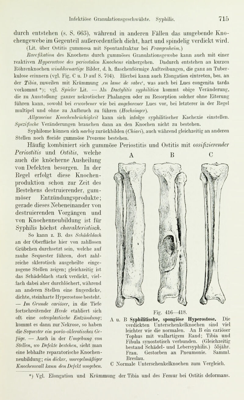 durch L'utstcheii (s. S. 6G3), während in anderen Fällen das umgebende Kno- chengewebe im Gegenteil außerordentlich dicht, hart und spindelig verdicirt wird. (Lit. über Ostitis gummosa mit Spontaiilialvtiu' bei Frangenheim.) Earcfikaiion des lüiochens durch gummöses Granulationsgewebe Ijann auch mit einer realctiven Hyperostose des periostalen Knochens einhergehen. Dadurch entstehen an kiu'zen Röhrenknoclien icinddornartige Bdder, d. h. flasclienförmige Auftreibungen, die ganz an Tuber- kulose erinnern (vgl. Fig. C u. D aiif S. 704). Hierbei kann auch Elongation eintreten, bes. an der TiUa, zuweilen mit Krümmung ,en latne de sabre\ was auch bei Lues congenita tarda vorkommt*); vgl. Spieler Lit. —Als Dactylitis syphilitica kommt obige Veränderung, die zu Ausstoßung ganzer neln'otischer Phalangen oder zu Resorption solcher ohne Eiterung führen kann, sowohl bei erworbener wie bei angeborener Lues vor, bei letzterer in der Regel multipel und ohne zu Aufbiuch zu führen (Hochsinger). Allgemeine Knochenbrüchigleit kann sich infolge sj^hüitischer Kachexie einstellen. Spezifische Verändeiningen brauchen dann an den Knoclien nicht zu bestehen. Sj'philome können sich narbig zurückbilden (Cliiari), auch während gleichzeitig an anderen Stellen noch floride gummöse Prozesse bestehen. Häufig kombiniert sich gummöse Periostitis und Ostitis mit ossifizierender Periostitis und Ostitis, welche auch die Imöcherne Ausheilung von Defekten besorgen. In der Regel erfolgt diese Knochen- Produktion schon zur Zeit des Bestehens destruierender, gum- möser Entziindungsprodukte; gerade dieses Nebeneinander von destruierenden Vorgängen und von Knochenneubildung ist für Syphilis höchst charaMeristisch. So kann z. B. das Schädeldach an der Oberfläche hier von zahllosen Grübchen durchsetzt sein, welche auf rauhe Sequester fuhren, dort zahl- reiche sklerotisch ausgeheilte einge- zogene Stellen zeigen; gleichzeitig ist das Schädeldach stark verdickt, viel- fach dabei aber durchlöchert, wälrrend an anderen Stellen eine fingercUcke, dichte, steinharte H^i^jerostose besteht. — Im Grunde cariöser, in die Tiefe fortschreitender Herde etabliert sich oft eine osteoplastische Entzündung; kommt es dann zur Nekrose, so haben die Sequester ein porös-slderotisches Ge- füge. — Auch in der Umgehung von Stellen, wo Defekte bestehen, sieht man eine lebhafte reparatorische Knochen- neubildung; ein dicker, unregelmäßiger Knochenwall kann den Defekt umgehen. B C Fig. 416- A u. B Sypliilitisclic, spongiöse Hyperostose. Die verdickten Unterschenkelknochen sind viel leichter wie die normalen. An B ein cariöser Tophus mit wallartigeni Rand; Tibia und Fibula sjniostotiscli verbunden. (Gleichzeitig bestand Schädel- und Lebersyidiilis.) Böjähr. Frau. Gestorben an Pneumonie. Samml. Breslau. C Normale Unterschenkelknochen zum Vergleich. *) Vgl. Elongation und Krümmung der Tibia und des Femur bei Ostitis deformans.