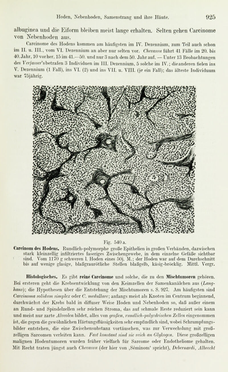 albuginea und die Eiform bleiben meist lange erhalten. Selten gehen Garcinome von Nebenhoden aus. Carcinome des Hodens kommen am häufigsten im IV. Dezennium, zum Teil auch schon im II. u. III., vom VI. Dezennium an al.ier nur selten vor. Chevassu führt 41 Fälle im 20. bis 40. Jahr, 10 vorher. 15 im 41.—50. und nur 3 nach dem 50. Jahr auf. — Unter 13 Beoljachtungen des Ter/nsser'sbetrafen 3 Individuen im III. Dezennium, 5 solche un IV.; dieanderen fielen ins V. Dezennium (1 Fall), ins VI. (2) und ins VII. u. VIII. (je ein Fall); das älteste Individuum war 75jäluig. Fig. 540 a. Carcinoiii des Hodeiis. Rundlich-polymorphe große Epithehen in großen Verbänden, dazwischen stark kleinzellig iiifiltriertes faseriges Zwischengewebe, in dem einzelne Gefäße sichtbar ' sind. Vom 1170 g schweren 1. Hoden eines 50j. M.; der Hoden war auf dem Durchschnitt bis aul wenige glasige, blaßgrauröthche Stellen Ijlaßgelb, käsig-bröcklig. Mittl. Vergr. Histologisches. Es gibt reine Carcinome und solche, die zu den Mischtiinioren gehören. Bei ersteren geht die Krebsentwicklnng von den Keimzellen der Sanienkanälchen aus (Lang- hans); die Hypothesen über die Entstehung der Mischtumoren s. S. 927. Am häufigsten sind Carcinoma solidum simplex oder C. medulläre; anfangs meist als Knoten im Centrum beginnend, durchwächst der Krebs bald in diffuser AVeise Hoden und Nebenhoden so, daß außer einem an Rund- und Spindelzellen sehr reichen Stroma, das auf schmale Reste reduziert sein kann und meist irar zarte Alveolen bildet, alles von großen, nmdUch-pohjcdrisehcn Zellen eingenommen ist, die gegen die gewöhnhchen Härtungsflüssigkeiten sehr empfindlich sind, wobei Schnimpfungs- bUder entstehen, die eine Zwischensubstanz vortäuschen, was zur Verwechslung mit groß- zelligen Sarcomen verleiten kann. Fasl lionslanl sind sie reich, an Glykogen. Diese großzelhgen malignen Hodentumoren wurden früher vielfach für Sarcome oder Endotheliome gehalten. Mit Recht traten jüngst auch Chevassu (der hier von ,Seminom' spricht), Dehernardi, Älireeht