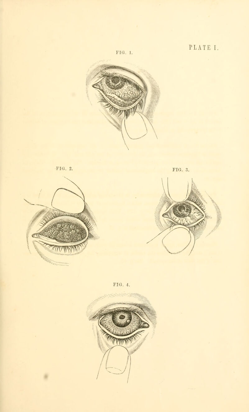 i i<; i. FIG. 2. FIG. 3.