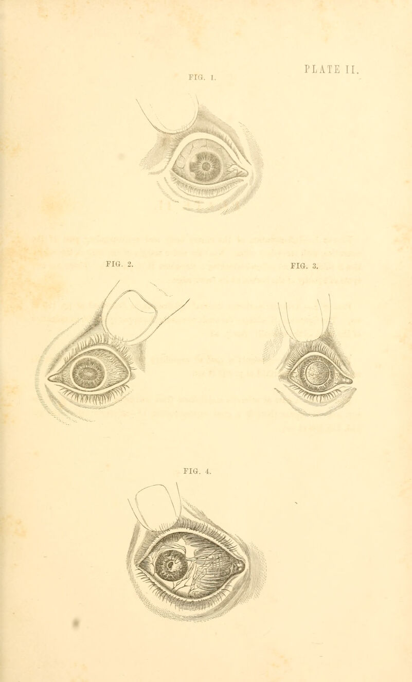 FIG. 2. FIG. 3.