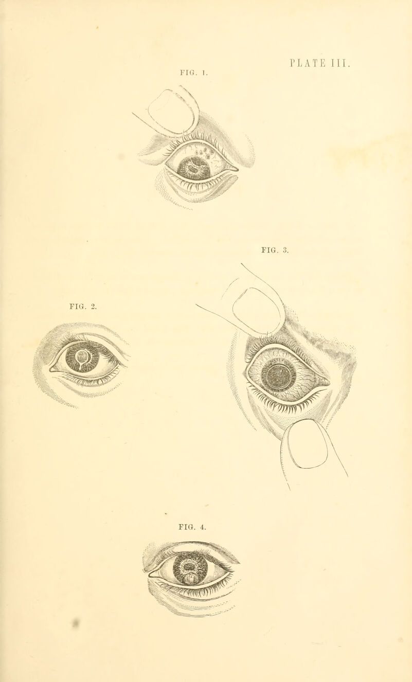 1'IC. I. -* '-^ ' ^ ^^r?^ ■ FIG. FIG. 2.