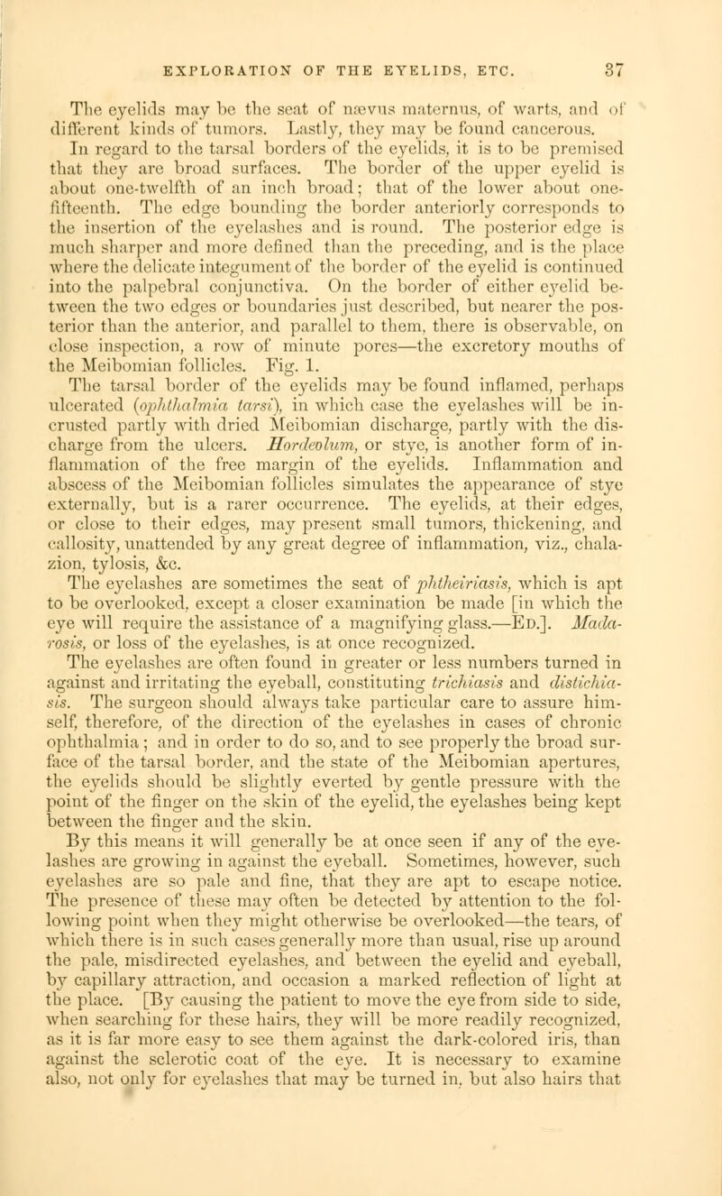 The eyelids may be the seat of najvus maternus, of warts, and of different kinds of tumors. Lastly, they may be found cancerous. In regard to the tarsal borders of the eyelids, it is to be premised that they are broad surfaces. The border of the upper eyelid is about one-twelfth of an inch broad; that of the lower about one- fifteenth. The edge bounding the border anteriorly corresponds to the insertion of the eyelashes and is round. The posterior edge is much sharper and more defined than the preceding, and is the place where the delicate integument of the border of the eyelid is continued into the palpebral conjunctiva. On the border of either eyelid be- tween the two edges or boundaries just described, but nearer the pos- terior than the anterior, and parallel to them, there is observable, on close inspection, a row of minute pores—the excretory mouths of the Meibomian follicles. Fig. 1. The tarsal border of the eyelids may be found inflamed, perhaps ulcerated (ophtlialmia tarsi), in which case the eyelashes will be in- crusted partly with dried Meibomian discharge, partly with the dis- charge from the ulcers. Hordeolum, or stye, is another form of in- flammation of the free margin of the eyelids. Inflammation and abscess of the Meibomian follicles simulates the appearance of stye externally, but is a rarer occurrence. The eyelids, at their edges, or close to their edges, may present small tumors, thickening, and callosity, unattended by any great degree of inflammation, viz., chala- zion, tylosis, &c. The eyelashes are sometimes the seat of phtheiriasis, which is apt to be overlooked, except a closer examination be made [in which the eye will require the assistance of a magnifying glass.—Ed.]. Mada- rosis, or loss of the eyelashes, is at once recognized. The eyelashes are often found in greater or less numbers turned in against and irritating the eyeball, constituting trichiasis and distichia- sis. The surgeon should always take particular care to assure him- self, therefore, of the direction of the eyelashes in cases of chronic ophthalmia; and in order to do so, and to see properly the broad sur- face of the tarsal border, and the state of the Meibomian apertures, the eyelids should be slightly everted by gentle pressure with the point of the finger on the skin of the eyelid, the eyelashes being kept between the finger and the skin. By this means it will generally be at once seen if any of the eye- lashes are growing in against the eyeball. Sometimes, however, such eyelashes are so pale and fine, that they are apt to escape notice. The presence of these may often be detected by attention to the fol- lowing point when they might otherwise be overlooked—the tears, of which there is in such cases generally more than usual, rise up around the pale, misdirected eyelashes, and between the eyelid and eyeball, by capillary attraction, and occasion a marked reflection of light at the place. [By causing the patient to move the eye from side to side, when searching for these hairs, they will be more readily recognized, as it is far more easy to see them against the dark-colored iris, than against the sclerotic coat of the eye. It is necessary to examine also, not only for eyelashes that may be turned in, but also hairs that