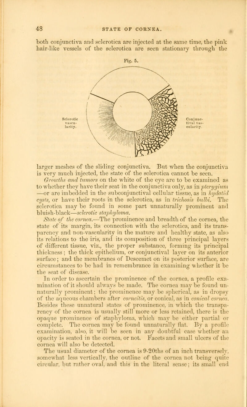 both conjunctiva and sclerotica are injected at the same time, the pink hair-like vessels of the sclerotica are seen stationary through the Fig. 5. Sclerotic vascu- larity. Conjunc- tival vas- cularity. larger meshes of the sliding conjunctiva. But when the conjunctiva is very much injected, the state of the sclerotica cannot be seen. Growths and tumors on the white of the eye are to be examined as to whether they have their seat in the conjunctiva only, as in pterygium —or are imbedded in the subconjunctival cellular tissue, as in hydatid cysts, or have their roots in the sclerotica, as in trichosis hulbi. The sclerotica may be found in some part unnaturally prominent and bluish-black—sclerotic staphyloma. State of the cornea.—The prominence and breadth of the cornea, the state of its margin, its connection with the sclerotica, and its trans- parency and non-vascularity in the mature and healthy state, as also its relations to the iris, and its composition of three principal layers of different tissue, viz., the proper substance, forming its principal thickness ; the thick epithelium, or conjunctival layer on its anterior surface; and the membranes of Descemet on its posterior surface, are circumstances to be had in remembrance in examining whether it be the seat of disease. In order to ascertain the prominence of the cornea, a profile exa- mination of it should always be made. The cornea may be found un- naturally prominent; the prominence may be spherical, as in dropsy of the aqueous chambers after corneitis, or conical, as in conical cornea. Besides these unnatural states of prominence, in which the transpa- rency of the cornea is usually still more or less retained, there is the opaque prominence of staphyloma, which may be either partial or complete. The cornea may be found unnaturally flat. By a profile examination, also, it will be seen in any doubtful case whether an opacity is seated in the cornea, or not. Facets and small ulcers of the cornea will also be detected. The usual diameter of the cornea is 9-20ths of an inch transversely, somewhat less vertically, the outline of the cornea not being quite circular, but rather oval, and this in the literal sense: its small end