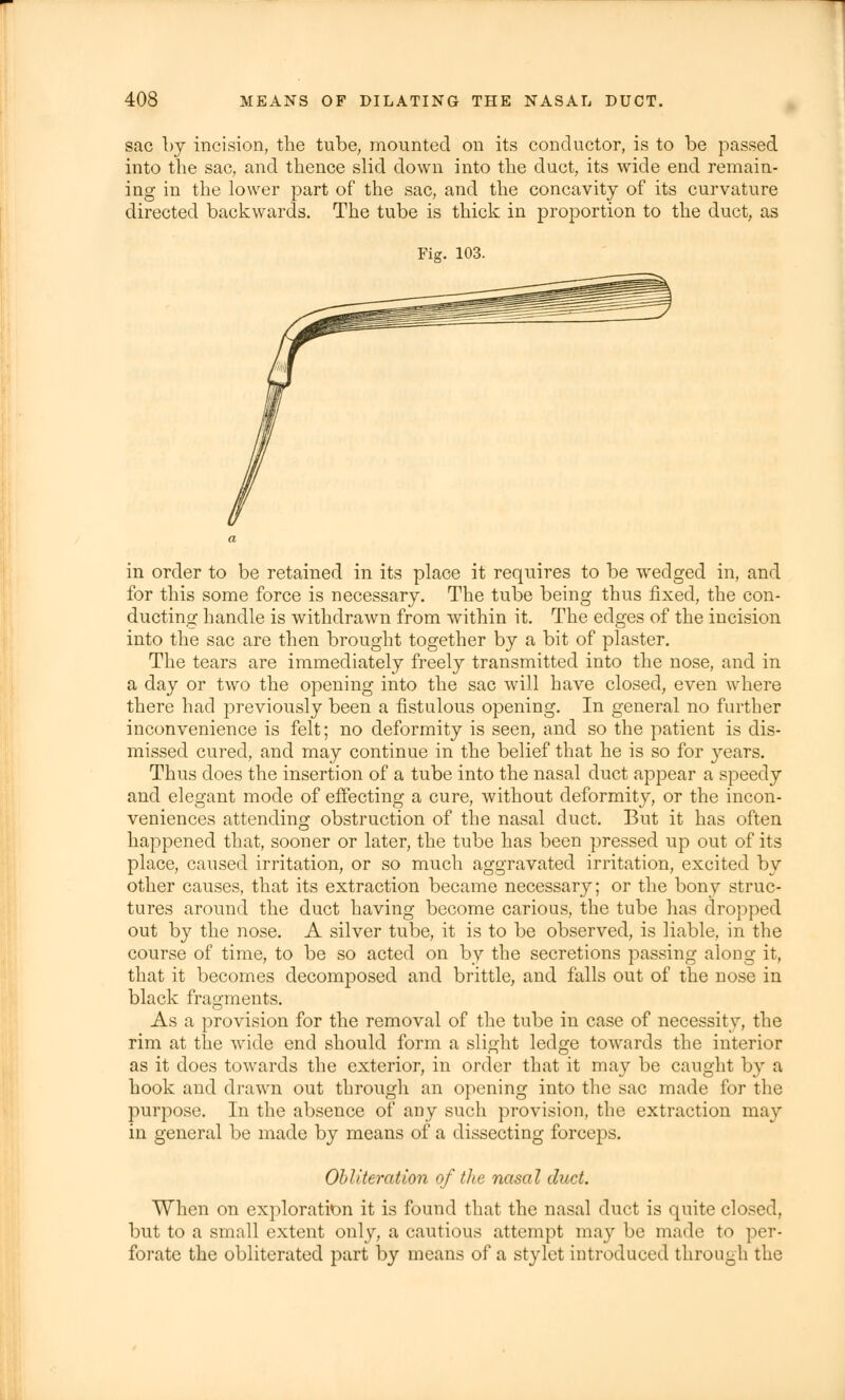 sac by incision, the tube, mounted on its conductor, is to be passed into the sac, and thence slid down into the duct, its wide end remain- ing in the lower part of the sac, and the concavity of its curvature directed backwards. The tube is thick in proportion to the duct, as 103. in order to be retained in its place it requires to be wedged in, and for this some force is necessary. The tube being thus fixed, the con- ducting handle is withdrawn from within it. The edges of the incision into the sac are then brought together by a bit of plaster. The tears are immediately freely transmitted into the nose, and in a day or two the opening into the sac will have closed, even where there had previously been a fistulous opening. In general no further inconvenience is felt; no deformity is seen, and so the patient is dis- missed cured, and may continue in the belief that he is so for years. Thus does the insertion of a tube into the nasal duct appear a speedy and elegant mode of effecting a cure, without deformity, or the incon- veniences attending obstruction of the nasal duct. But it has often happened that, sooner or later, the tube has been pressed up out of its place, caused irritation, or so much aggravated irritation, excited by other causes, that its extraction became necessary; or the bony struc- tures around the duct having become carious, the tube has dropped out by the nose. A silver tube, it is to be observed, is liable, in the course of time, to be so acted on by the secretions passing along it, that it becomes decomposed and brittle, and falls out of the nose in black fragments. As a provision for the removal of the tube in case of necessity, the rim at the wide end should form a slight ledge towards the interior as it does towards the exterior, in order that it may be caught by a hook and drawn out through an opening into the sac made for the purpose. In the absence of any such provision, the extraction may in general be made by means of a dissecting forceps. Obliteration of the nasal duct. When on exploration it is found that the nasal duct is quite closed, but to a small extent only, a cautious attempt may be made to per- forate the obliterated part by means of a stylet introduced through the