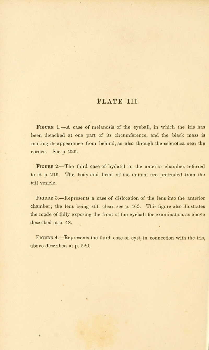 Figure 1.—A case of melanosis of the eyeball, in which the iris has been detached at one part of its circumference, and the black mass is making its appearance from behind, as also through the sclerotica near the cornea. See p. 226. Figure 2.—The third case of hydatid in the anterior chamber, referred to at p. 216. The body and head of the animal are protruded from the tail vesicle. Figure 3.—Represents a case of dislocation of the lens into the anterior chamber; the lens being still clear, see p. 465. This figure also illustrates the mode of fully exposing the front of the eyeball for examination, as above described at p. 48. Figure 4.—Represents the third case of cyst, in connection with the iris, above described at p. 220.