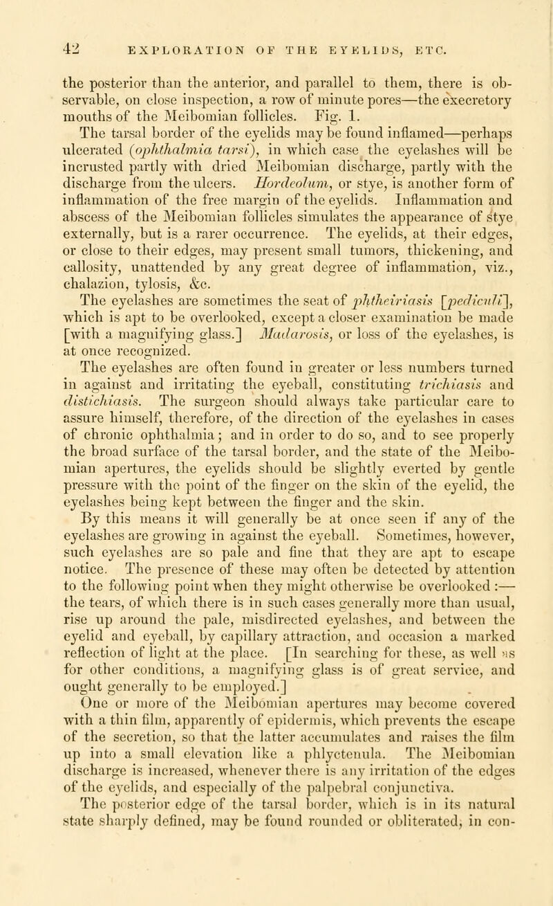 the posterior than the anterior, and parallel to them, there is ob- servable, on close inspection, a row of minute pores—the execretory mouths of the Meibomian follicles. Fig. 1. The tarsal border of the eyelids may be found inflamed—perhaps ulcerated (ophthalmia tarsi), in which case the eyelashes will be incrusted partly with dried Meibomian discharge, partly with the discharge from the ulcers. Hordeolum, or stye, is another form of inflammation of the free margin of the eyelids. Inflammation and abscess of the Meibomian follicles simulates the appearance of stye externally, but is a rarer occurrence. The eyelids, at their edges, or close to their edges, may present small tumors, thickening, and callosity, unattended by any great degree of inflammation, viz., chalazion, tylosis, &c. The eyelashes are sometimes the seat of phtheiriasis [pedicnli], which is apt to be overlooked, except a closer examination be made [with a magnifying glass.] Madarosis, or loss of the eyelashes, is at once recognized. The eyelashes are often found in greater or less numbers turned in against and irritating the eyeball, constituting trichiasis and distichiasis. The sui'geon should always take particular care to assure himself, therefore, of the direction of the eyelashes in cases of chronic ophthalmia; and in order to do so, and to see properly the broad surface of the tarsal border, and the state of the Meibo- mian apertures, the eyelids should be slightly everted by gentle pressure with the point of the finger on the skin of the eyelid, the eyelashes being kept between the finger and the skin. By this means it will generally be at once seen if any of the eyelashes are growing in against the eyeball. Sometimes, however, such eyelashes are so pale and fine that they are apt to escape notice. The presence of these may often be detected by attention to the following point when they might otherwise be overlooked :— the tears, of which there is in such cases generally more than usual, rise up around the pale, misdirected eyelashes, and between the eyelid and eyeball, by capillary attraction, and occasion a marked reflection of light at the place. [In searching for these, as well as for other conditions, a magnifying glass is of great service, and ought generally to be employed.] One or more of the Meibomian apertures may become covered with a thin film, apparently of epidermis, which prevents the escape of the secretion, so that the latter accumulates and raises the film up into a small elevation like a phlyctcnula. The Meibomian discharge is increased, whenever there is any irritation of the edges of the eyelids, and especially of the palpebral conjunctiva. The posterior edge of the tarsal border, which is in its natural state sharply defined, may be found rounded or obliterated, in con-
