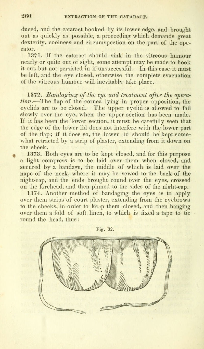 duced, and the cataract hooked by its lower edge, and brought out as quickly as possible, a proceeding which demands great dexterity, coolness and circumspection on the part of the ope- rator. 1371. If the cataract should sink in the vitreous humour nearly or quite out of sight, some attempt may be made to hook it out, but not persisted in if unsuccessful. In this case it must be left, and the eye closed, otherwise the complete evacuation of the vitreous humour will inevitably take place. 1372. Bandaging of the eye and treatment after the opera- tion.—The flap of the cornea lying in proper apposition, the eyelids are to be closed. The upper eyelid is allowed to fall slowly over the eye, when the upper section has been made. If it has been the lower section, it must be carefully seen that the edge of the lower lid does not interfere with the lower part of the flap; if it does so, the lower lid should be kept some- what retracted by a strip of plaster, extending from it down on the cheek. 1373. Both eyes are to be kept closed, and for this purpose a light compress is to be laid over them when closed, and secured by a bandage, the middle of which is laid over the nape of the neck, where it may be sewed to the back of the night-cap, and the ends brought round over the eyes, crossed on the forehead, and then pinned to the sides of the night-cap. 1374. Another method of bandaging the eyes is to apply over them strips of court plaster, extending from the eyebrows to the cheeks, in order to kejp them closed, and then hanging over them a fold of soft linen, to which is fixed a tape to tie round the head, thus : Fig. 32.