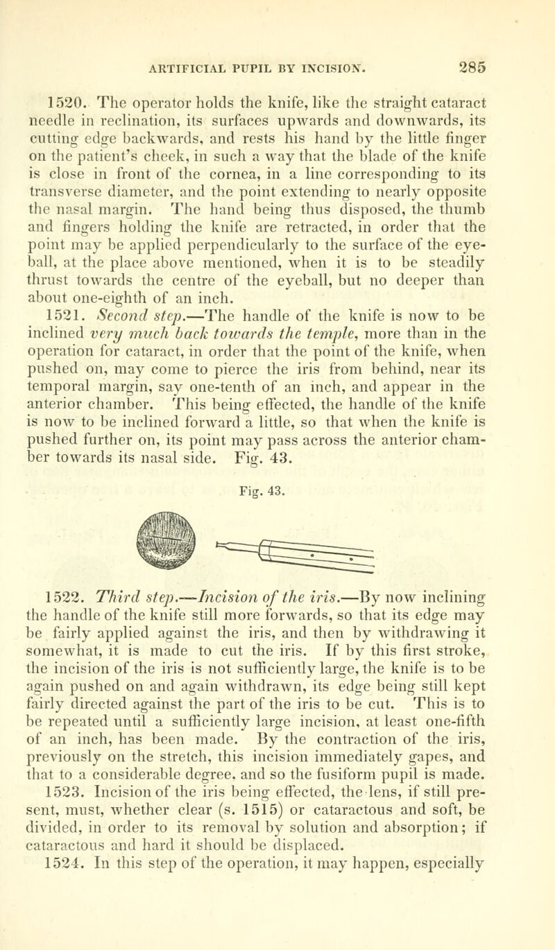 1520. The operator holds the knife, like the straight cataract needle in reclination, its surfaces upwards and downwards, its cutting edge backwards, and rests his hand by the little finger on the patient's cheek, in such a way that the blade of the knife is close in front of the cornea, in a line corresponding to its transverse diameter, and the point extending to nearly opposite the nasal margin. The hand being thus disposed, the thumb and fingers holding the knife are retracted, in order that the point may be applied perpendicularly to the surface of the eye- ball, at the place above mentioned, when it is to be steadily thrust towards the centre of the eyeball, but no deeper than about one-eighth of an inch. 1521. Second step.—The handle of the knife is now to be inclined very much back towards the temple, more than in the operation for cataract, in order that the point of the knife, when pushed on, may come to pierce the iris from behind, near its temporal margin, say one-tenth of an inch, and appear in the anterior chamber. This being effected, the handle of the knife is now to be inclined forward a little, so that when the knife is pushed further on, its point may pass across the anterior cham- ber towards its nasal side. Fig. 43. Fiff. 43. 1522. Third step.—Incision of the iris.—By now inclining the handle of the knife still more forwards, so that its edge may be fairly applied against the iris, and then by withdrawing it somewhat, it is made to cut the iris. If by this first stroke, the incision of the iris is not sufficiently large, the knife is to be again pushed on and again withdrawn, its edge being still kept fairly directed against the part of the iris to be cut. This is to be repeated until a sufficiently large incision, at least one-fifth of an inch, has been made. By the contraction of the iris, previously on the stretch, this incision immediately gapes, and that to a considerable degree, and so the fusiform pupil is made. 1523. Incision of the iris being effected, the lens, if still pre- sent, must, whether clear (s. 1515) or cataractous and soft, be divided, in order to its removal by solution and absorption; if cataractous and hard it should be displaced. 1524. In this step of the operation, it may happen, especially