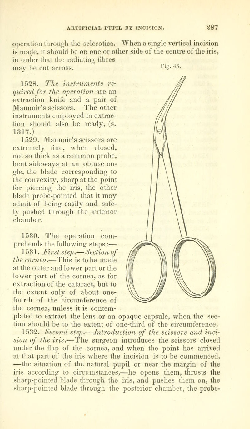 operation through the sclerotica. When a single vertical incision is made, it should he on one or other side of the centre of the iris, in order that the radiating fibres may be cut across. F)S- 4S- 1528. The instruments re- quired for the operation are an extraction knife and a pair of Maunoir's scissors. The other instruments employed in extrac- tion should also be ready, (s. 1317.) 1529. Maunoir's scissors are extremely fine, when closed, not so thick as a common probe, bent sideways at an obtuse an- gle, the blade corresponding to the convexity, sharp at the point for piercing the iris, the other blade probe-pointed that it may admit of being easily and safe- ly pushed through the anterior chamber. 1530. The operation com- prehends the following steps:— 1531. First step.—Section of the cornea.—This is to be made at the outer and lower part or the lower part of the cornea, as for extraction of the cataract, but to the extent only of about one- fourth of the circumference of the cornea, unless it is contem- plated to extract the lens or an opaque capsule, when the sec- tion should be to the extent of one-third of the circumference. 1532. Second step.—Introduction of the scissors and inci- sion of the iris.—The surgeon introduces the scissors closed under the flap of the cornea, and when the point has arrived at that part of the iris where the incision is to be commenced, —the situation of the natural pupil or near the margin of the iris according to circumstances,—he opens them, thrusts the sharp-pointed blade through the iris, and pushes them on, the sharp-pointed blade through the posterior chamber, the probe-