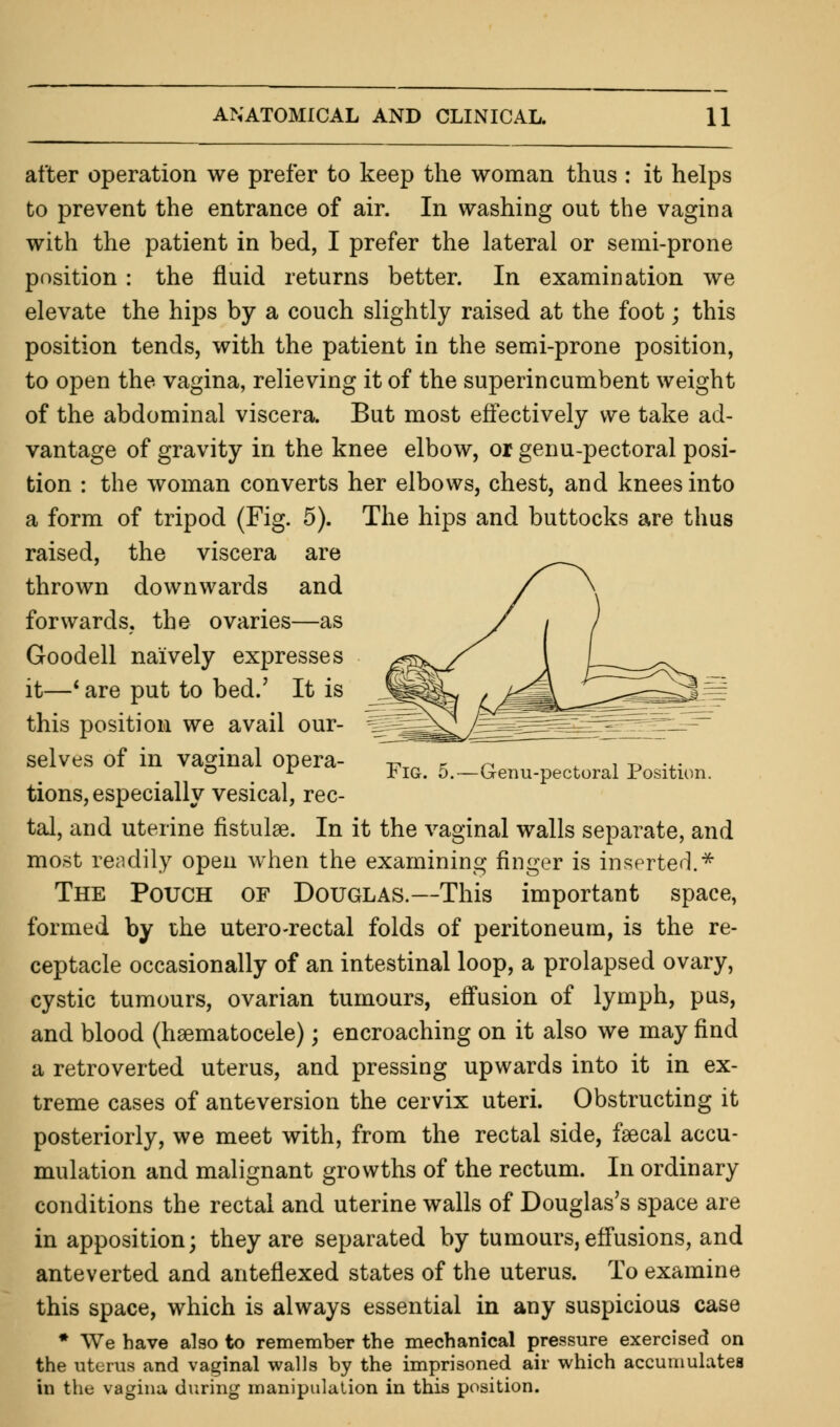 after operation we prefer to keep the woman thus : it helps to prevent the entrance of air. In washing out the vagina with the patient in bed, I prefer the lateral or semi-prone position : the fluid returns better. In examination we elevate the hips by a couch slightly raised at the foot; this position tends, with the patient in the semi-prone position, to open the vagina, relieving it of the superincumbent weight of the abdominal viscera. But most effectively we take ad- vantage of gravity in the knee elbow, or genu-pectoral posi- tion : the woman converts her elbows, chest, and knees into a form of tripod (Fig. 5). The hips and buttocks are thus raised, the viscera are thrown downwards and forwards, the ovaries—as Goodell naively expresses it—' are put to bed.' It is this position we avail our- selves of in vaginal opera- ,. K n , t> ... ° r rlG. o.—Genu-pectoral Position. tions, especially vesical, rec- tal, and uterine fistulae. In it the vaginal walls separate, and most readily open when the examining finger is inserted.* The Pouch of Douglas.—This important space, formed by the utero-rectal folds of peritoneum, is the re- ceptacle occasionally of an intestinal loop, a prolapsed ovary, cystic tumours, ovarian tumours, effusion of lymph, pus, and blood (hematocele); encroaching on it also we may find a retroverted uterus, and pressing upwards into it in ex- treme cases of anteversion the cervix uteri. Obstructing it posteriorly, we meet with, from the rectal side, faecal accu- mulation and malignant growths of the rectum. In ordinary conditions the rectal and uterine walls of Douglas's space are in apposition; they are separated by tumours, effusions, and anteverted and anteflexed states of the uterus. To examine this space, which is always essential in any suspicious case * We have also to remember the mechanical pressure exercised on the uterus and vaginal walls by the imprisoned air which accumulates in the vagina during manipulation in this position.