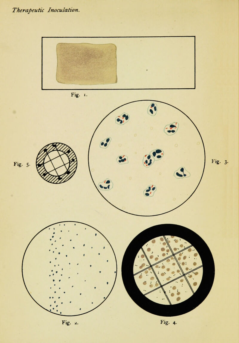 Fig. 5 Fig- 3-